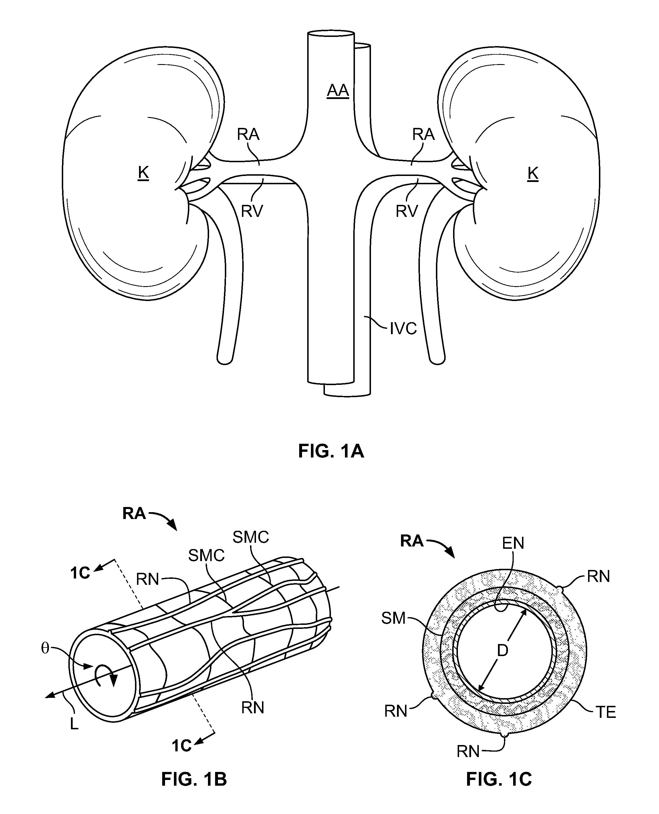 Cryo-induced renal neuromodulation devices and methods