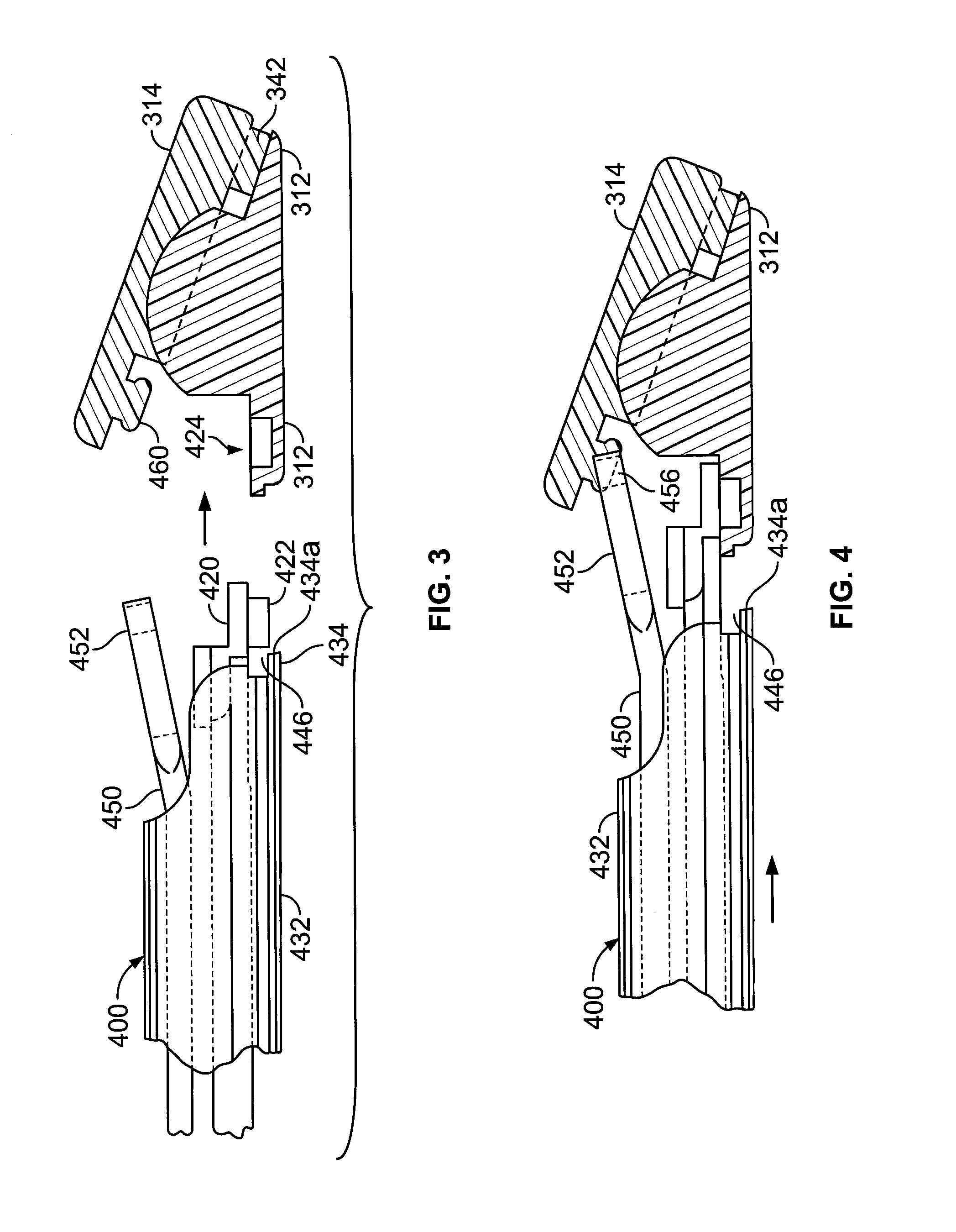 Joint Arthroplasty Devices Having Articulating Members