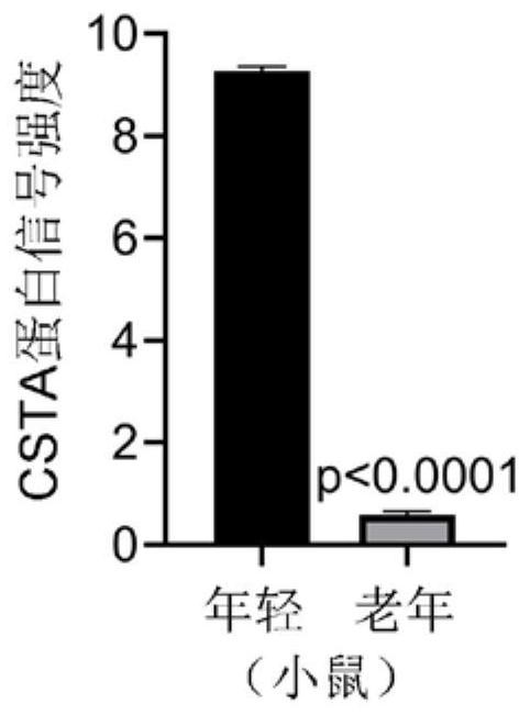 Application of calcipotriol as skin external medicine for preventing and treating senile osteoporosis