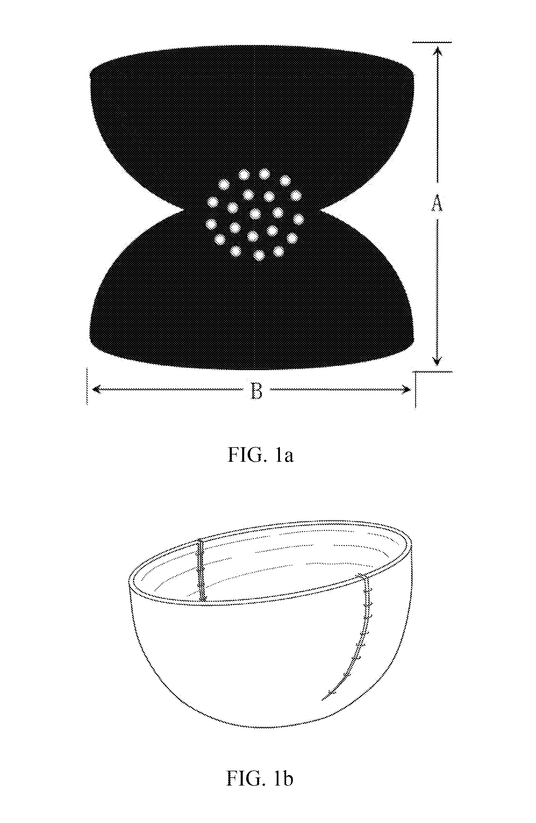Breast Prosthesis Support Device Based on Tissue Matrix Material, and Preparation Method Therefor
