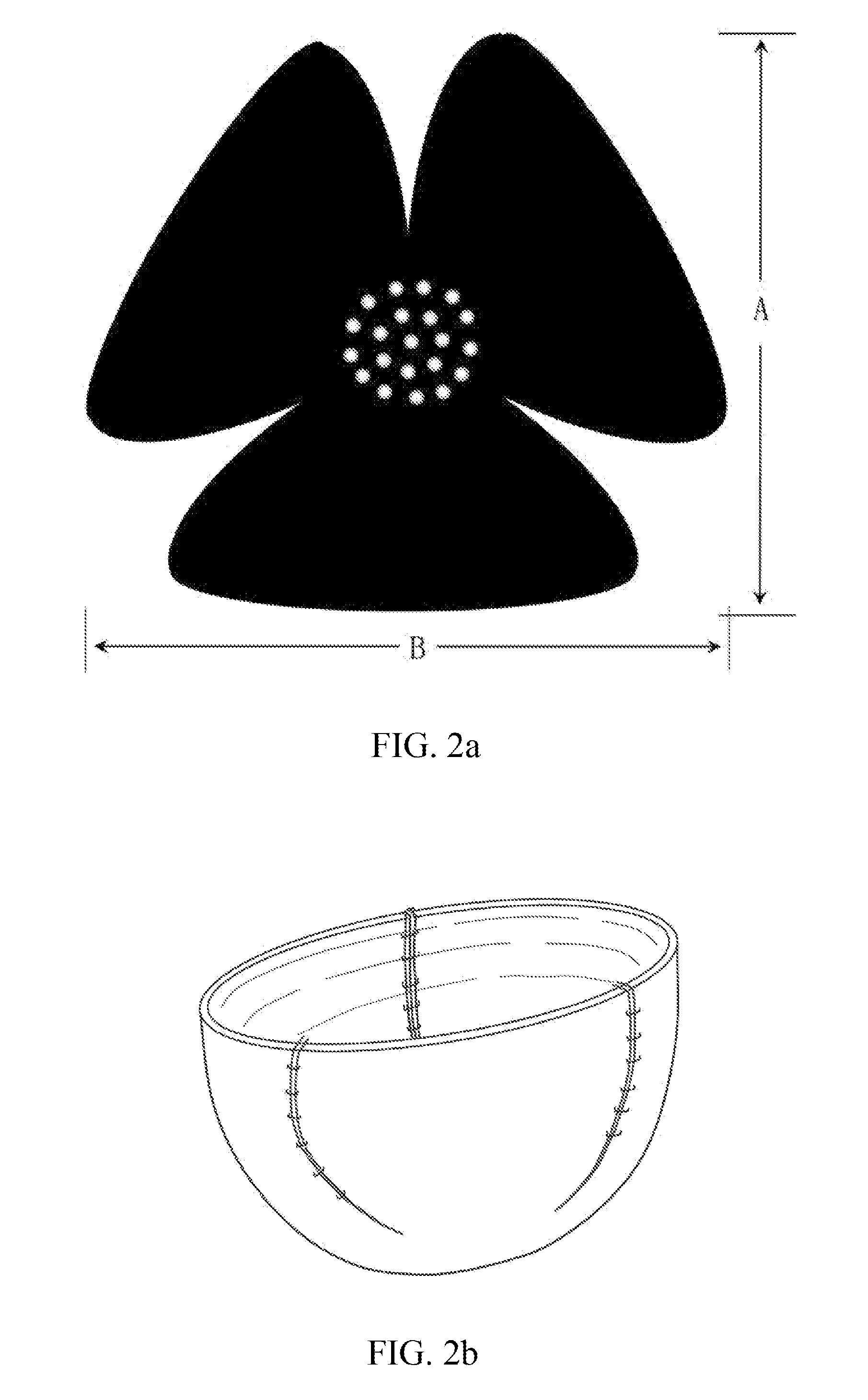 Breast Prosthesis Support Device Based on Tissue Matrix Material, and Preparation Method Therefor