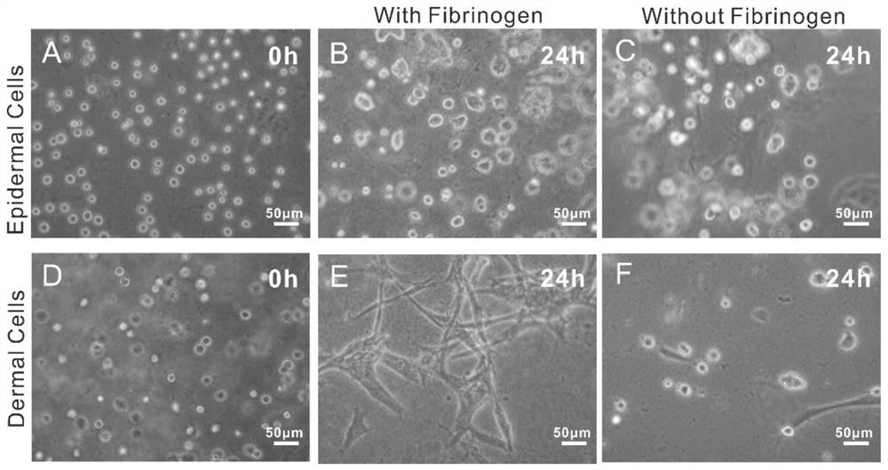 Skin bio-printing ink as well as preparation method and application thereof