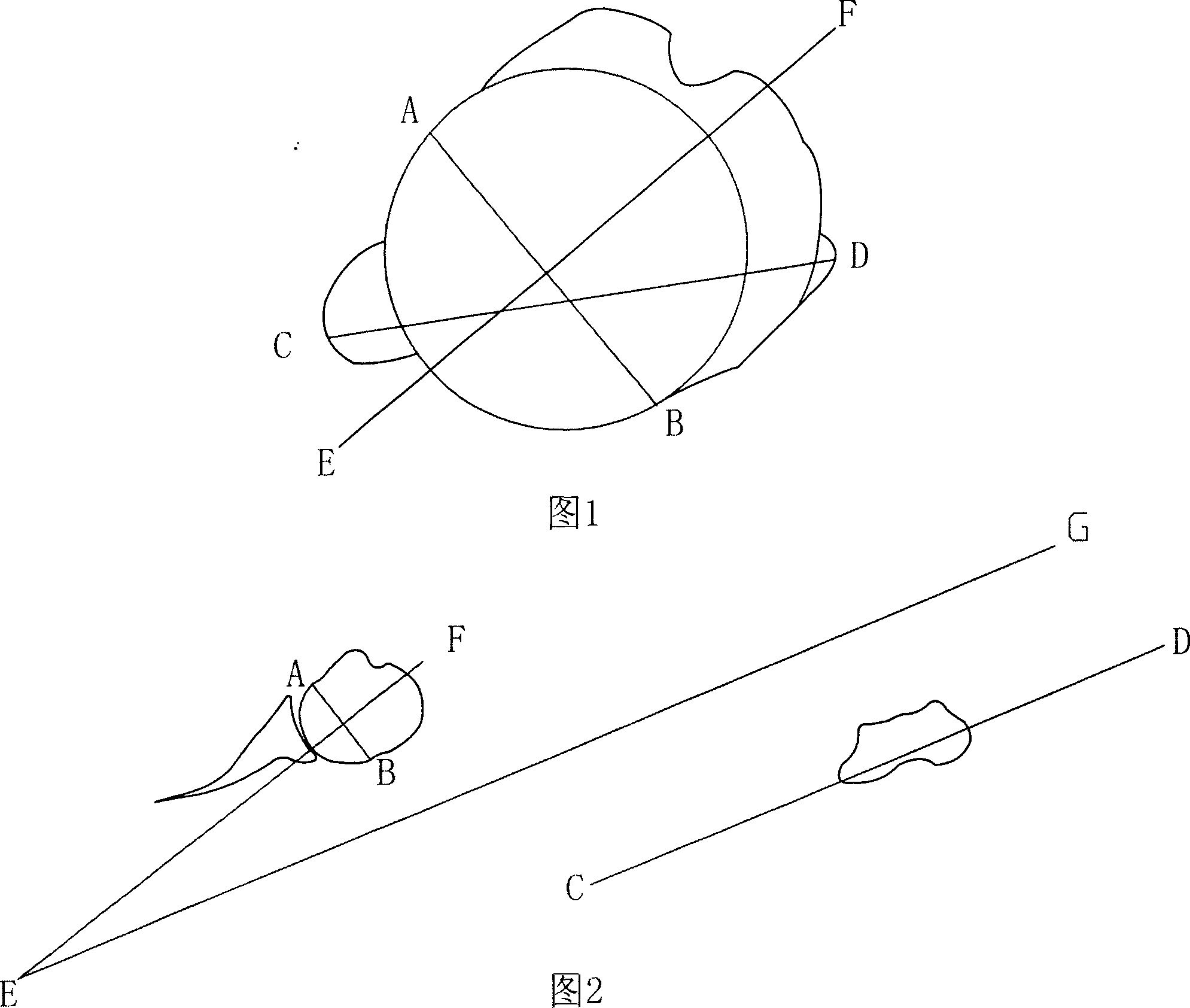 Method for measuring turning angle of humerus by using multiple line of CT three-D remodelling