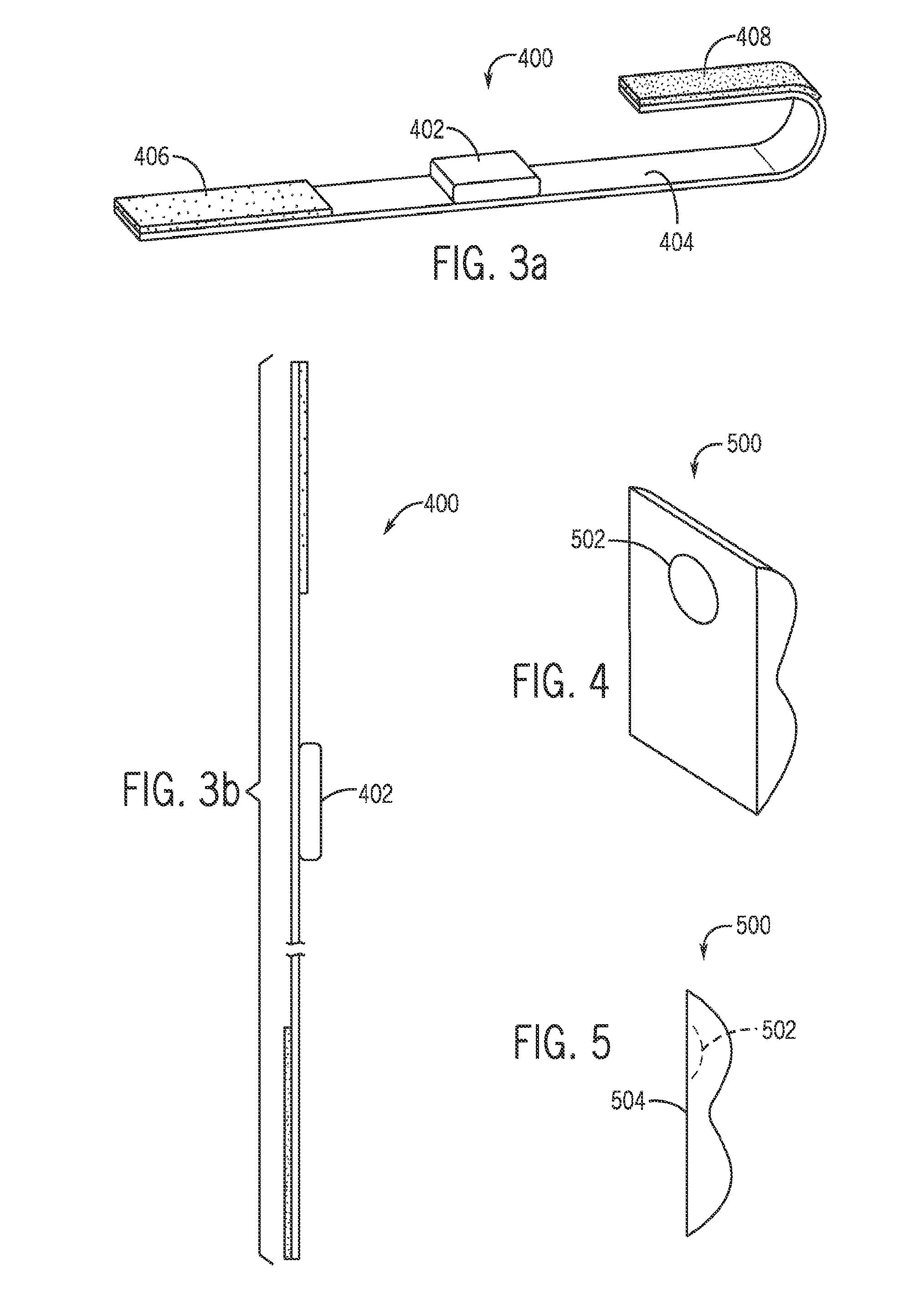 Compression device and pressure sensor for treatment of abnormal upper esophageal sphincter functionality