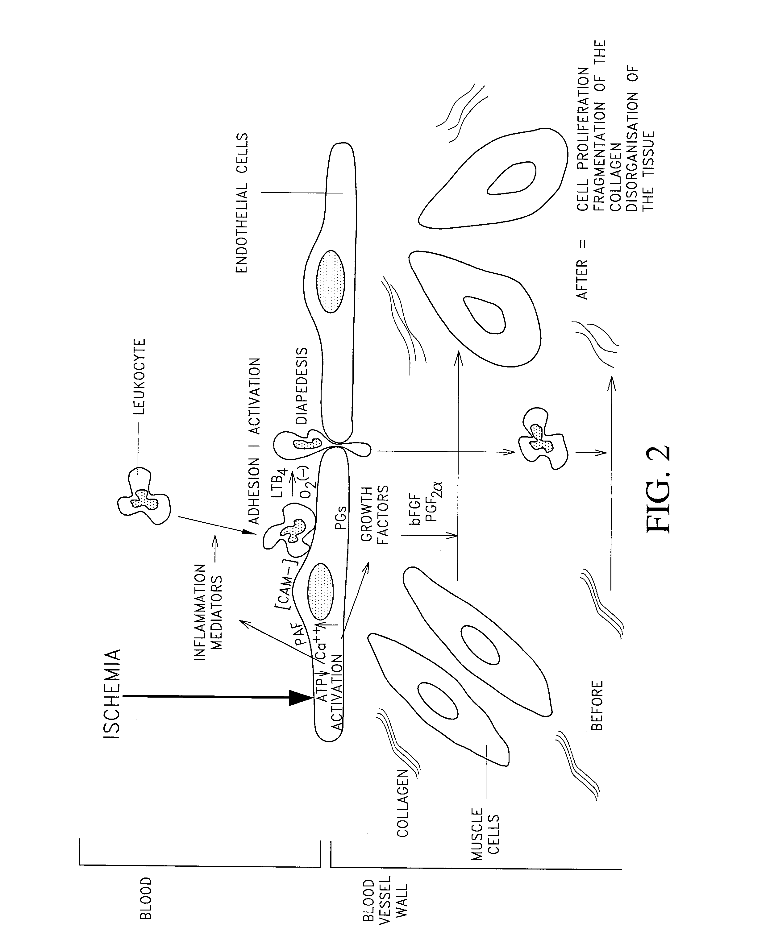 Use of a pharmaceutical composition for treating and/or preventing ischemia