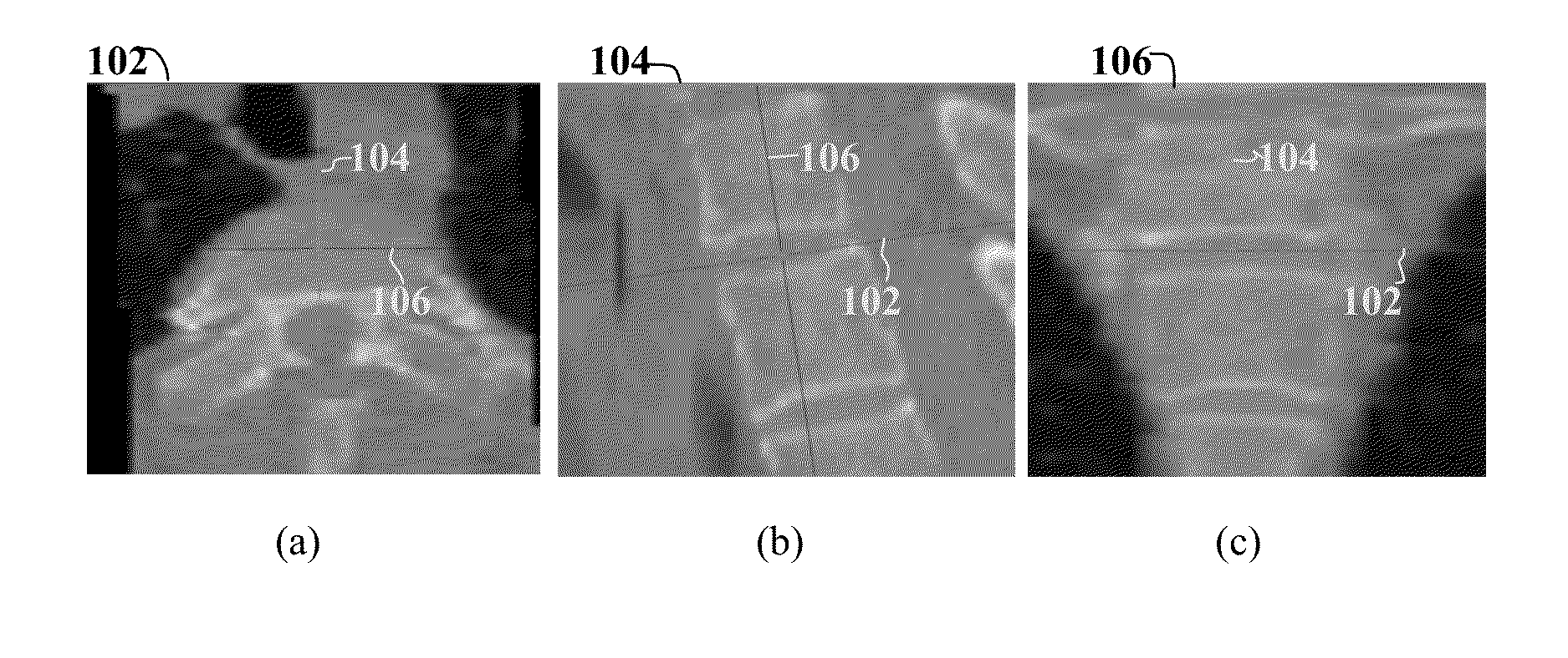 Method and System for On-Site Learning of Landmark Detection Models for End User-Specific Diagnostic Medical Image Reading