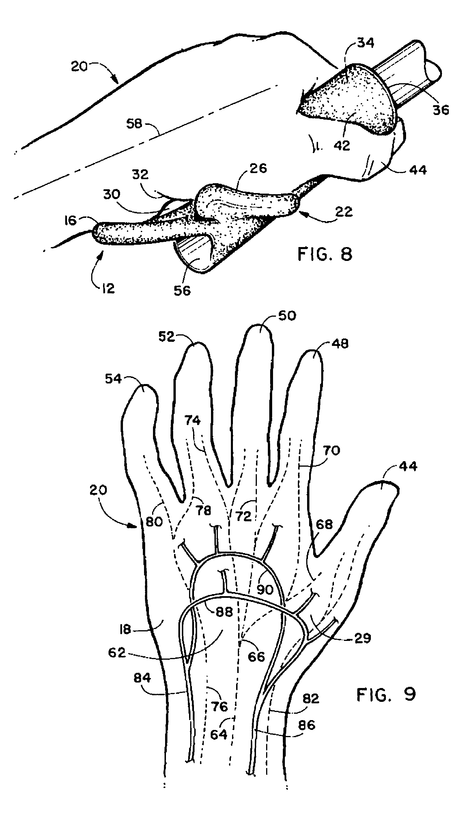 Ergonomic handgrip with separate ulnar and radial support means