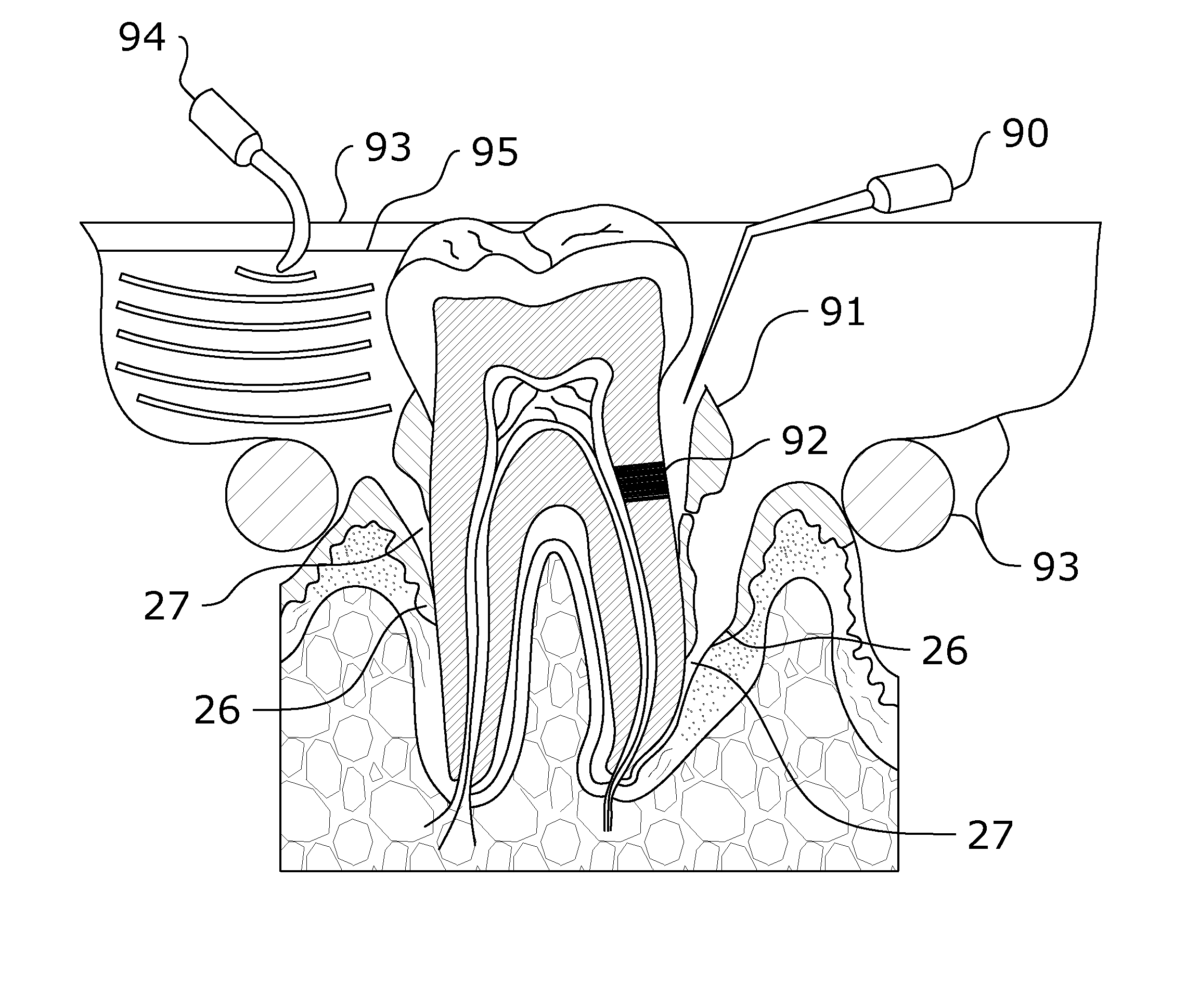 Oral Care System and Method