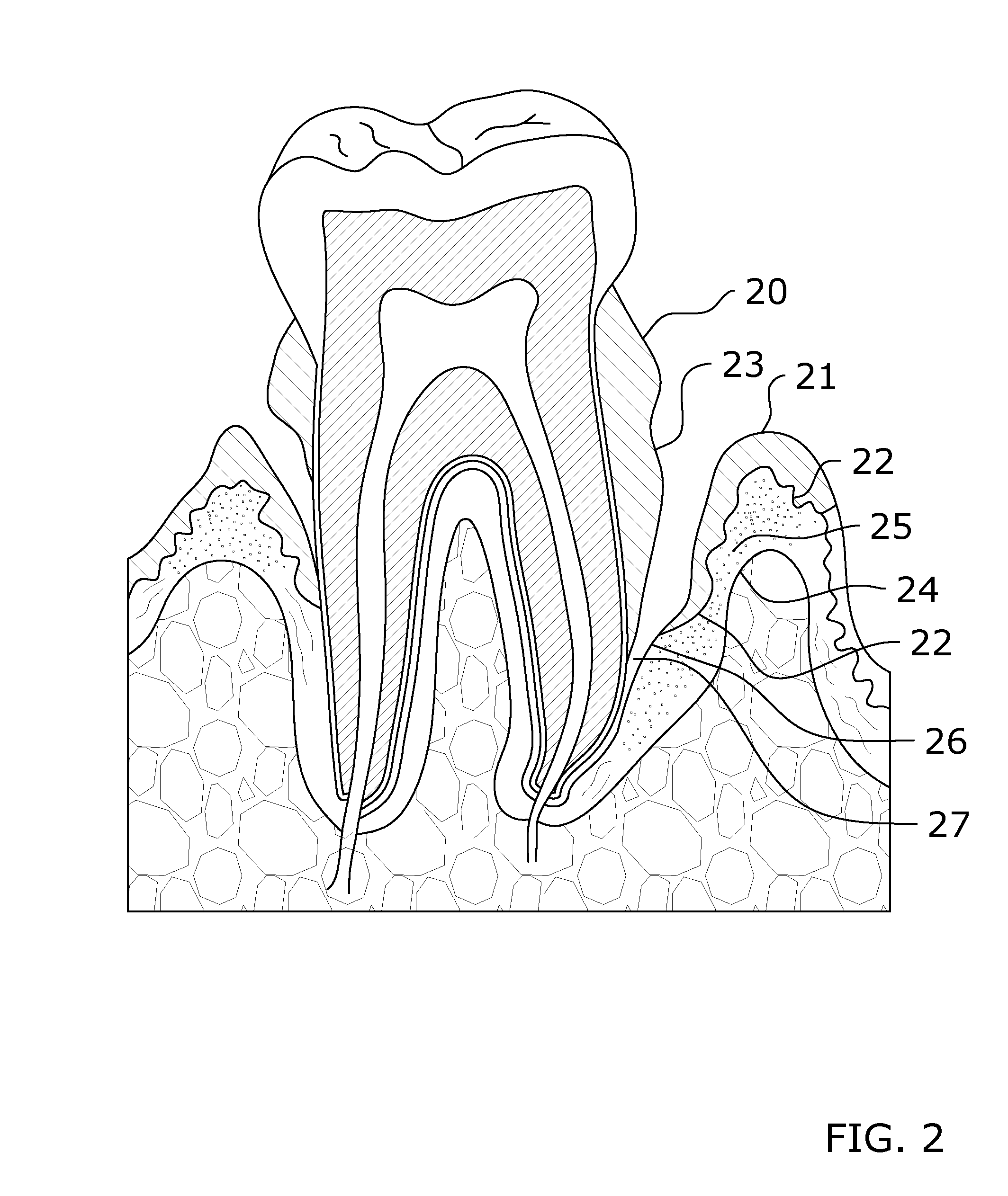 Oral Care System and Method