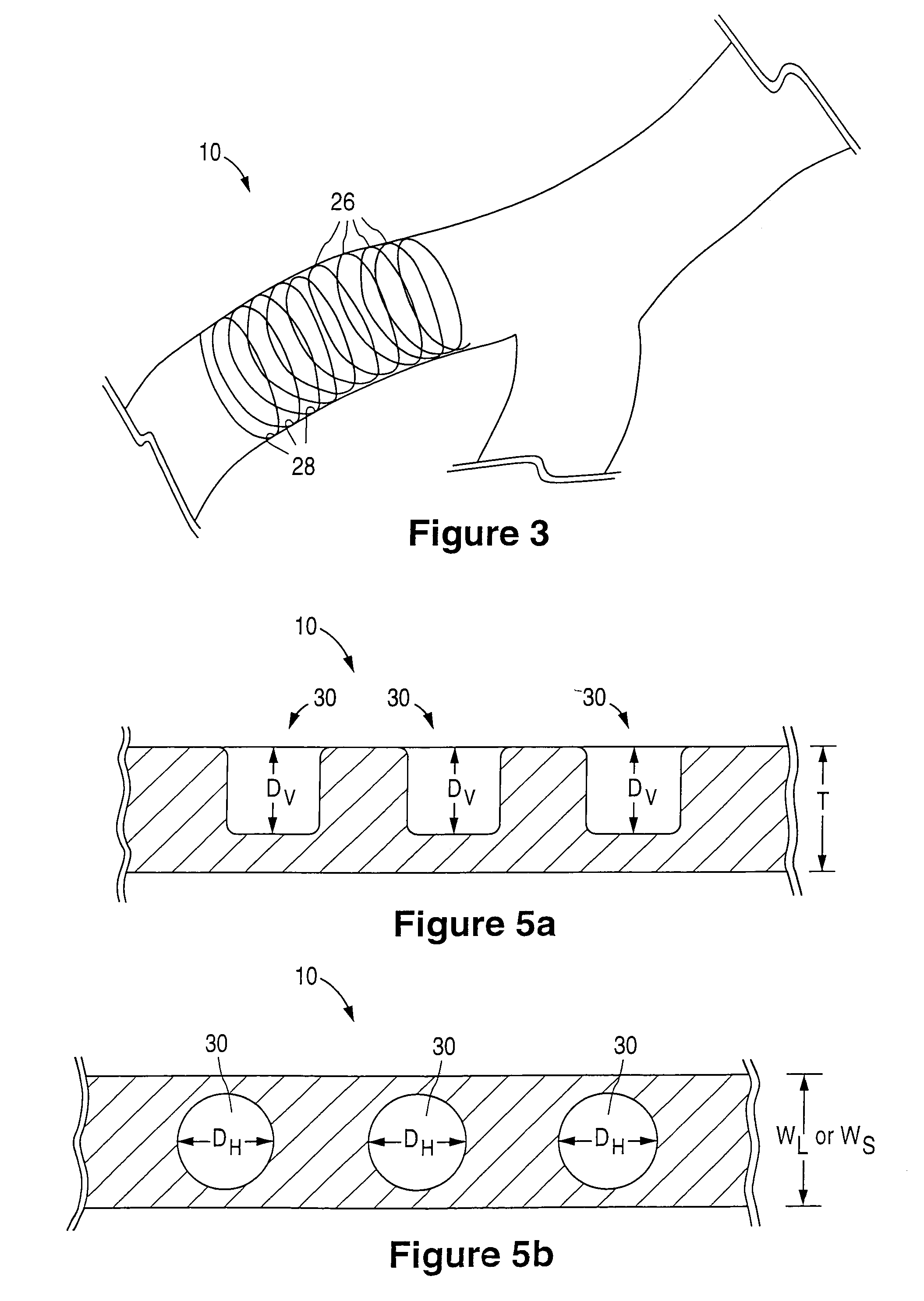 Increased drug-loading and reduced stress drug delivery device