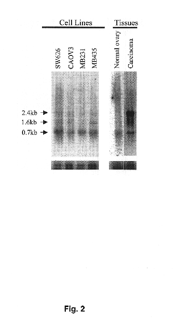 Transmembrane serine protease overexpressed in ovarian carcinoma and uses thereof