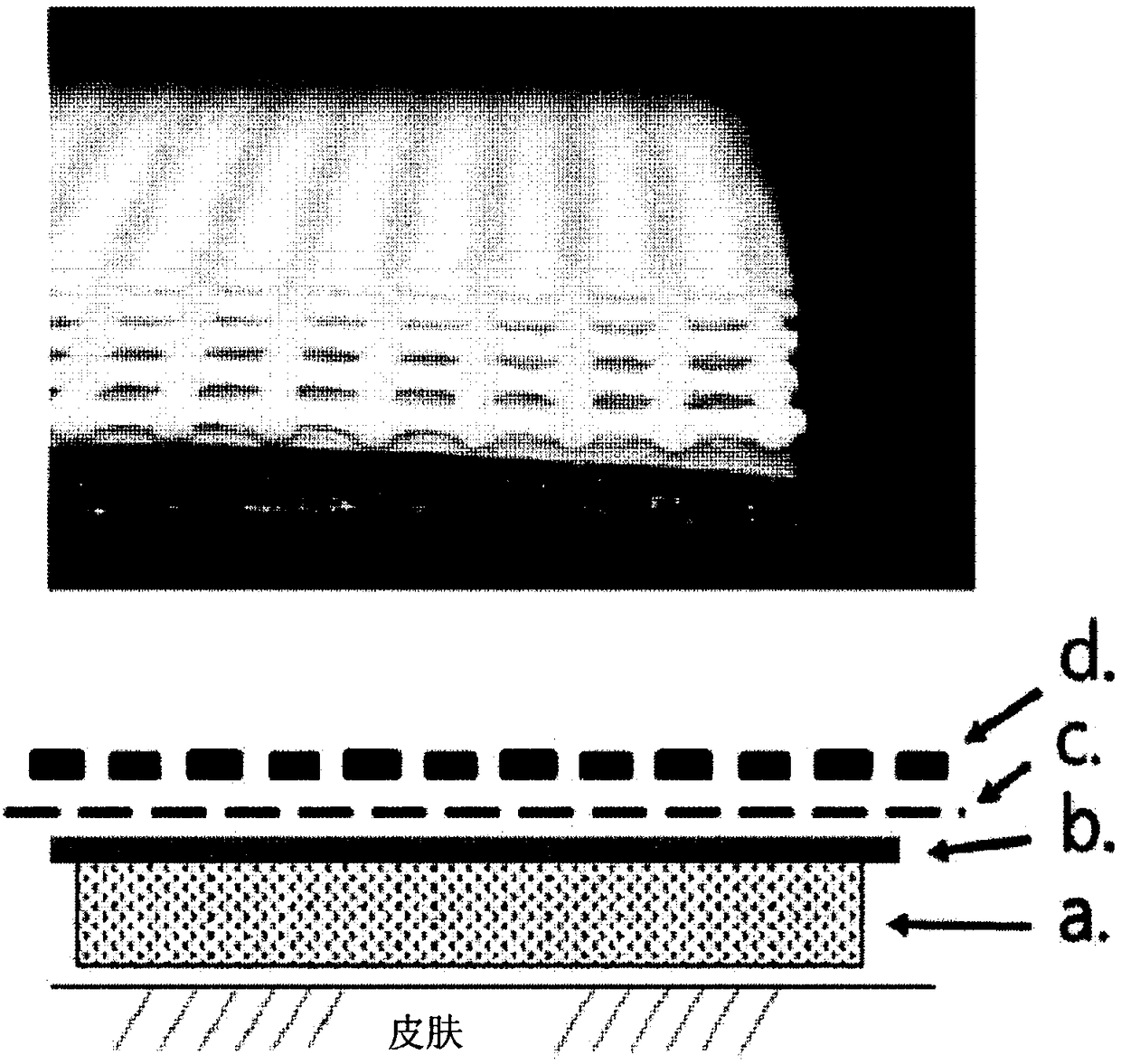 Pad for alleviating and treating plasma protein exudation skin diseases including atopic diseases