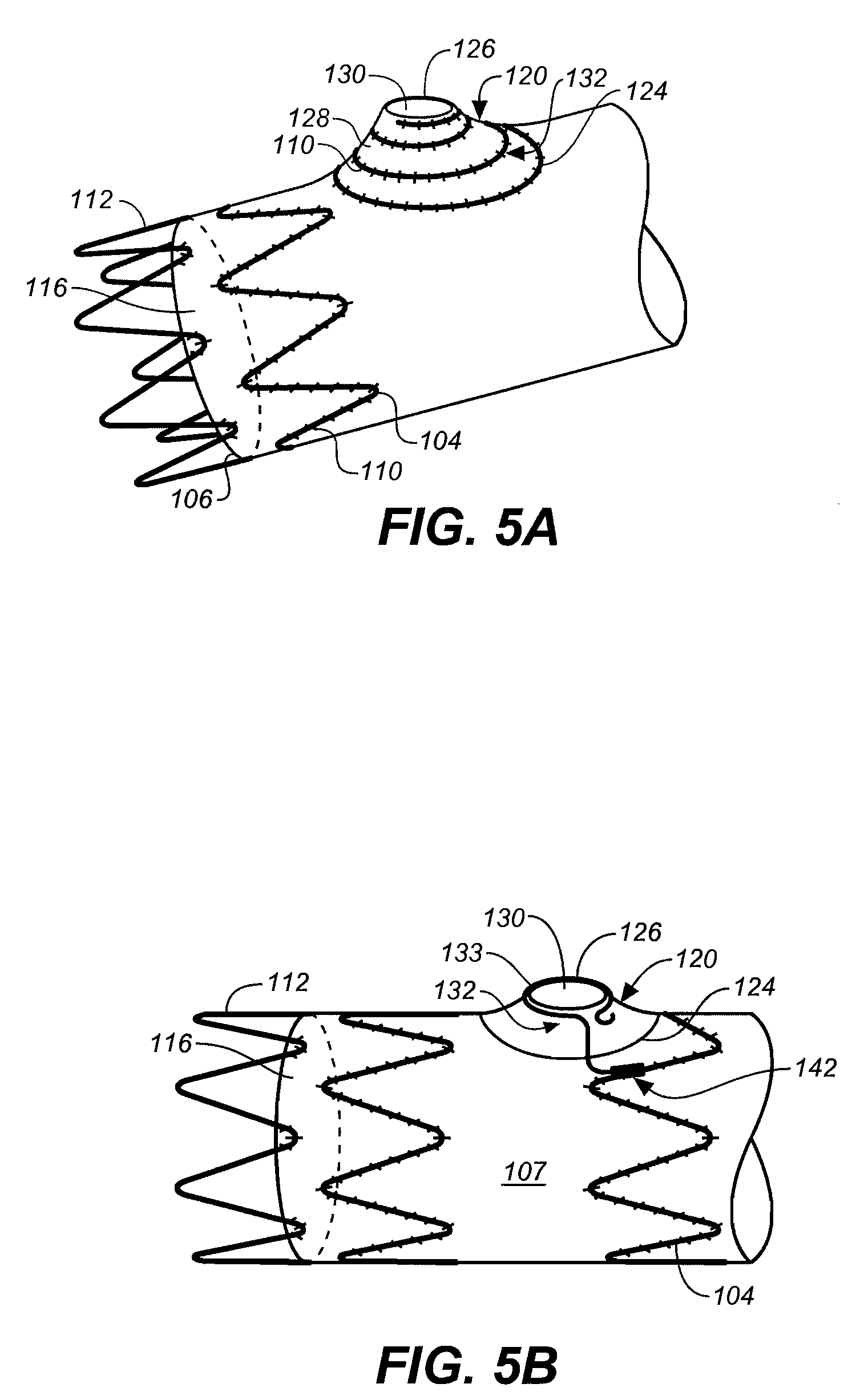 Mobile external coupling with internal sealing cuff for branch vessel connection