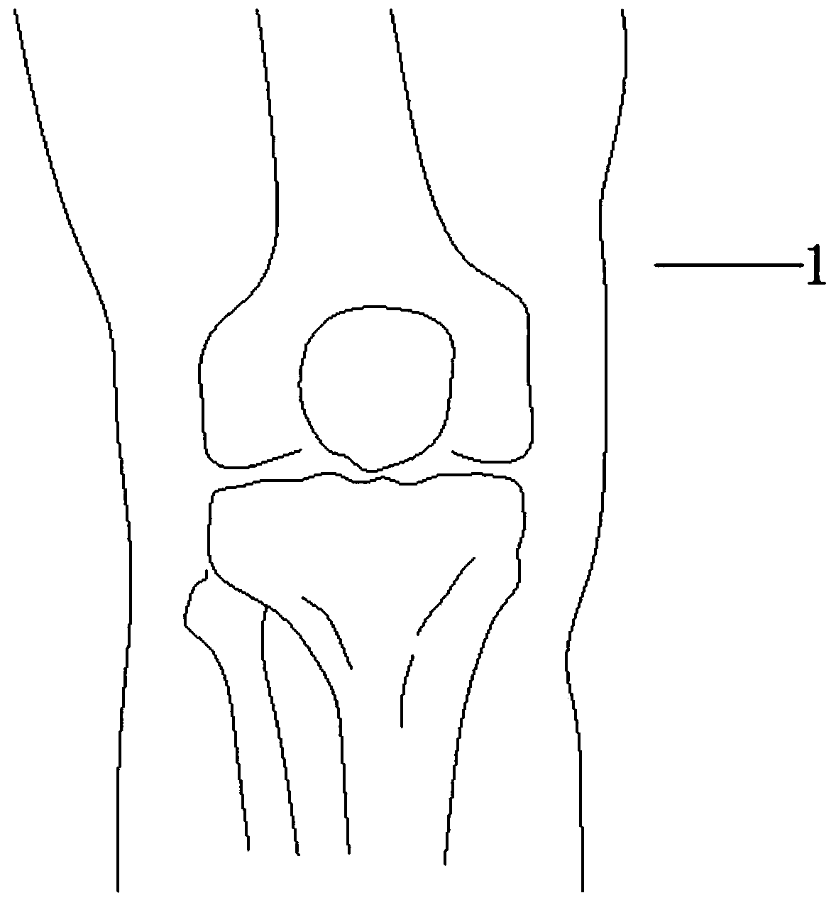 Device and method for standardized tracing of parts of pain and pressing pain of knee joints
