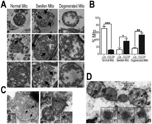 Novel target for diagnosis and treatment of TDP-43 protein disease