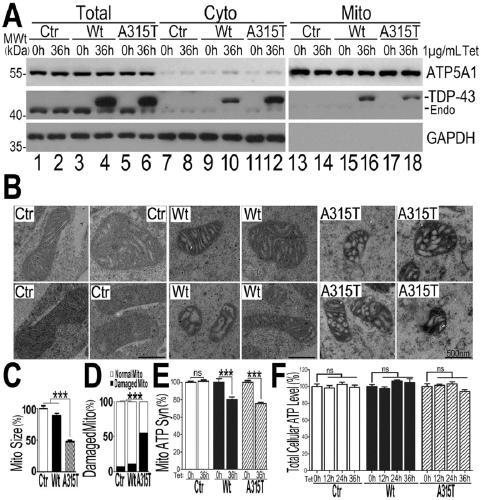 Novel target for diagnosis and treatment of TDP-43 protein disease