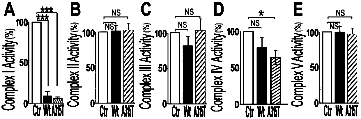 Novel target for diagnosis and treatment of TDP-43 protein disease