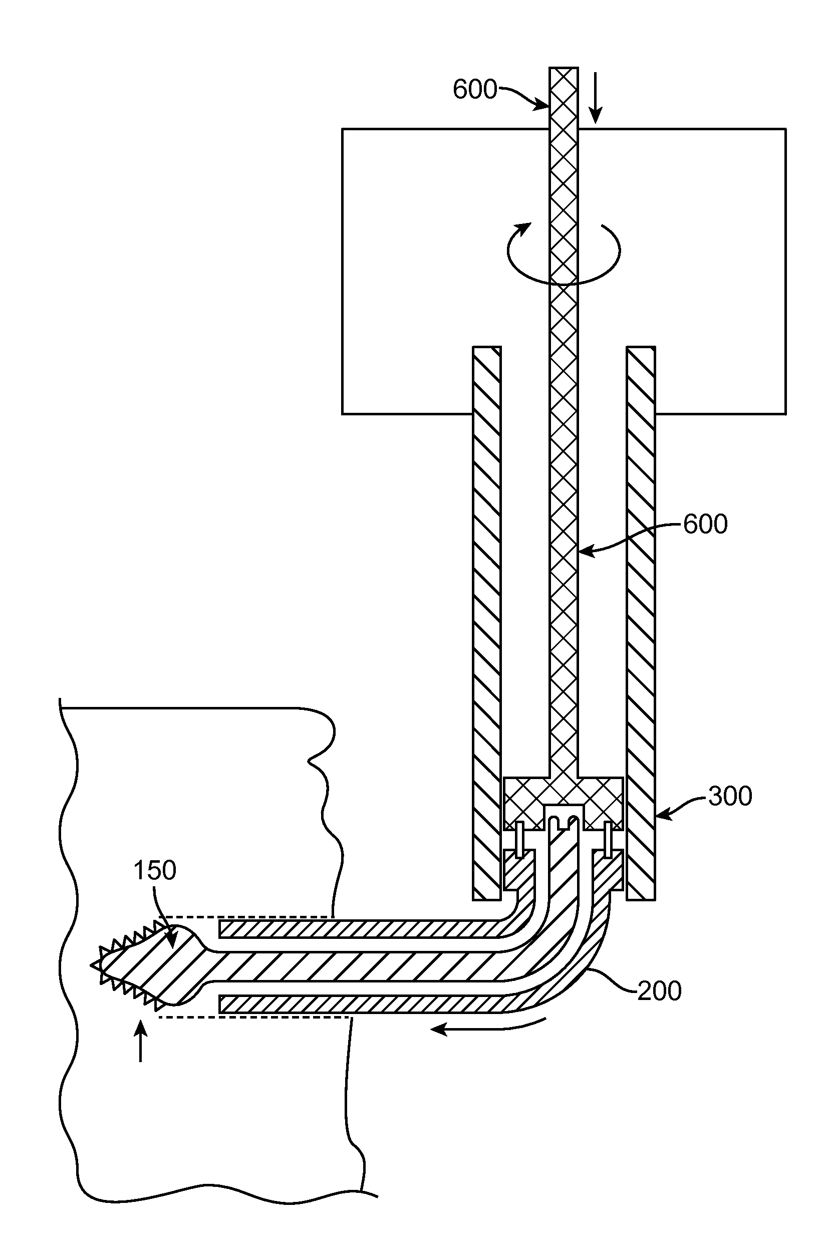 Ultrasound Enhanced Selective Tissue Removal Method and Apparatus