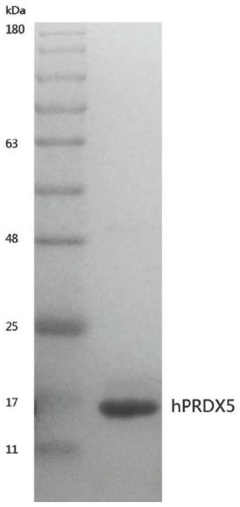 A host factor hprdx5 with anti-tumor effect, its coding gene and its application