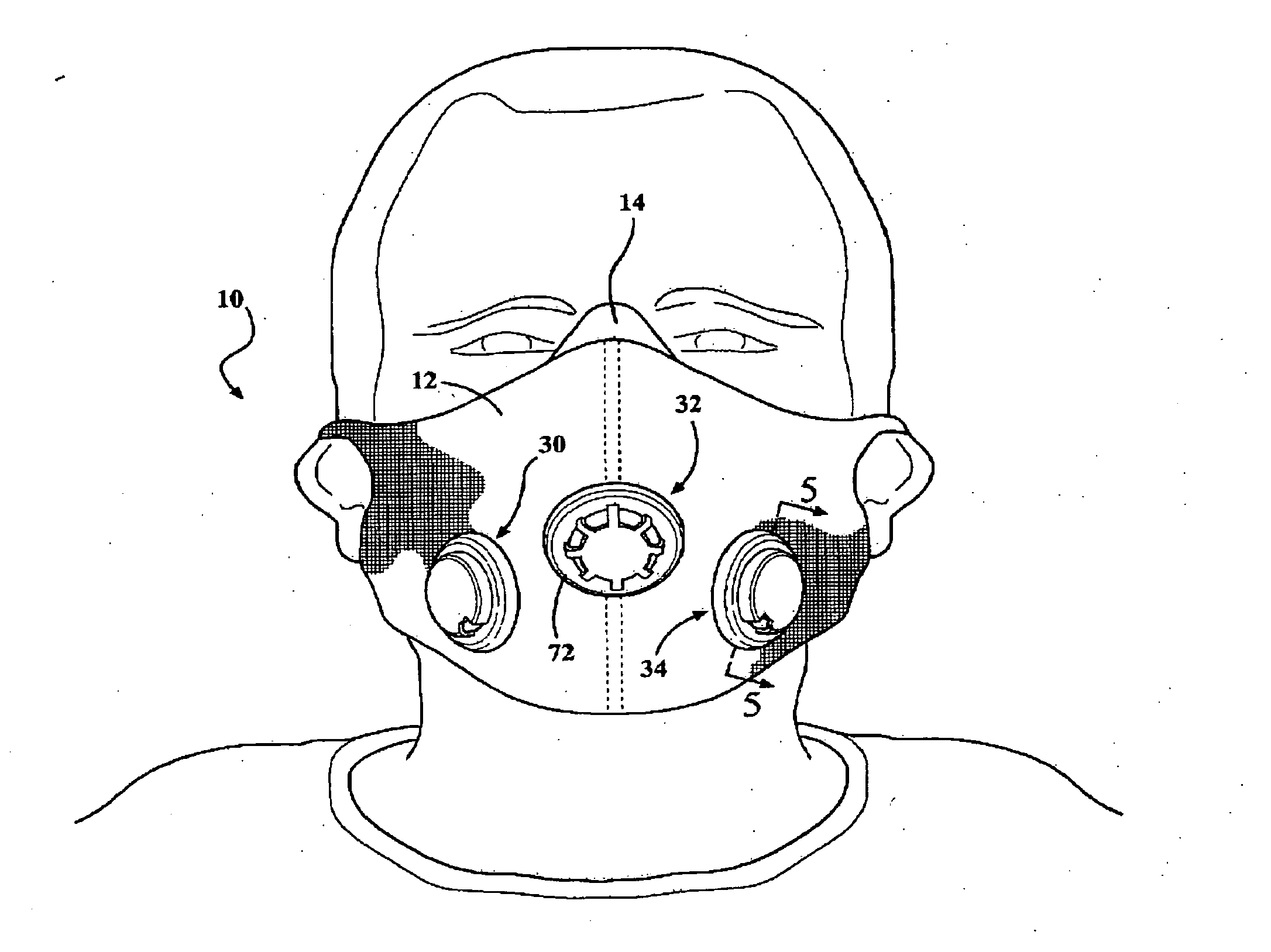 High performance ventilatory training mask incorporating multiple and adjustable air admittance valves for replicating various encountered altitude resistances