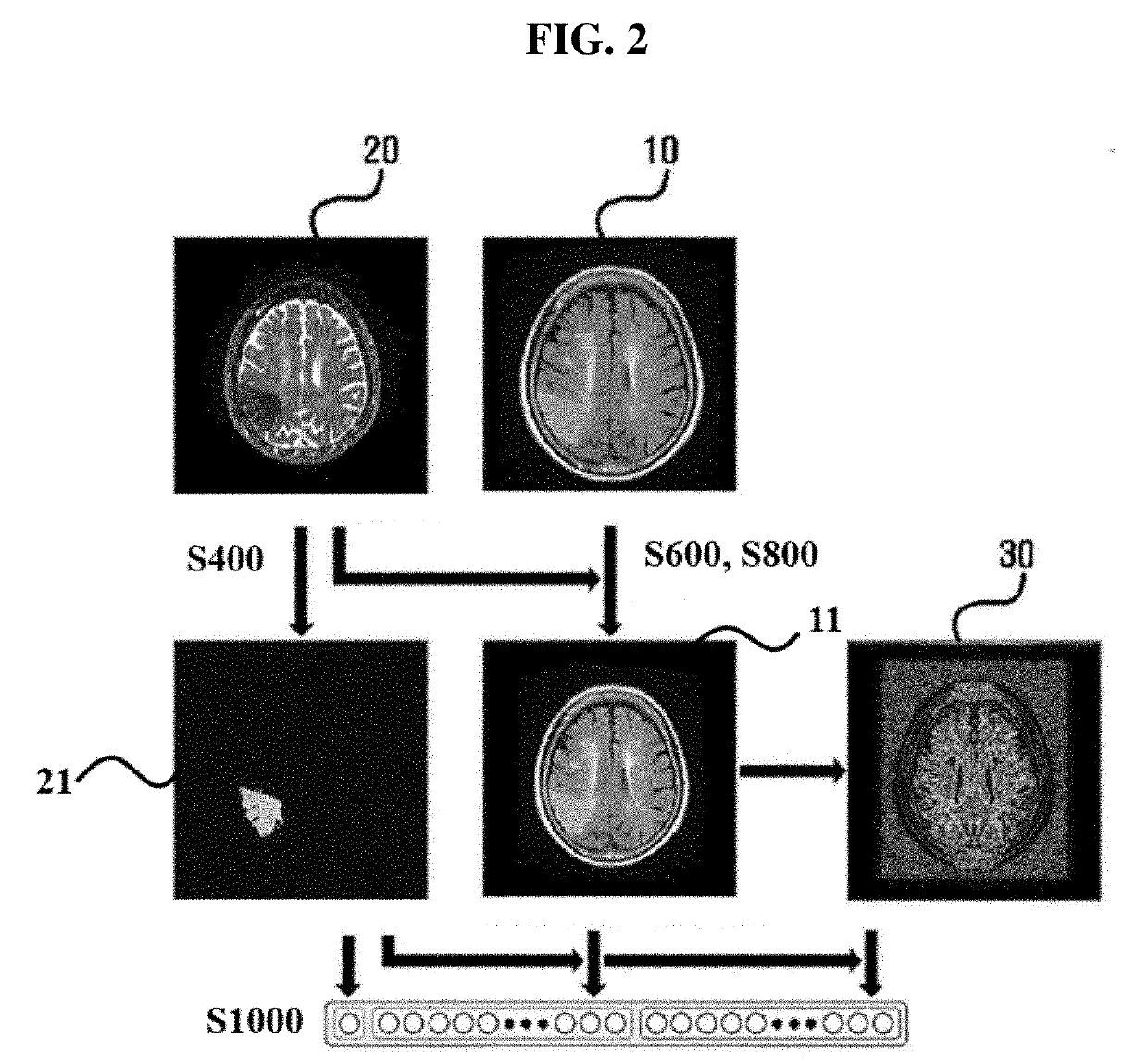 System and method for estimating acute cerebral infarction onset time