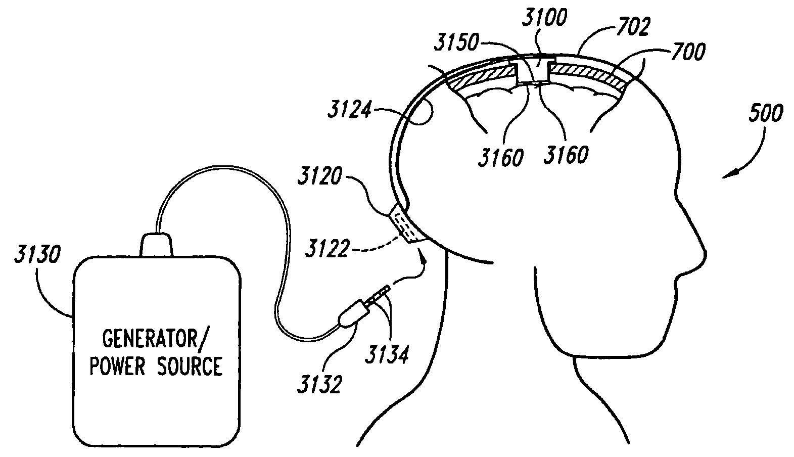 Methods and apparatus for effectuating a lasting change in a neural-function of a patient