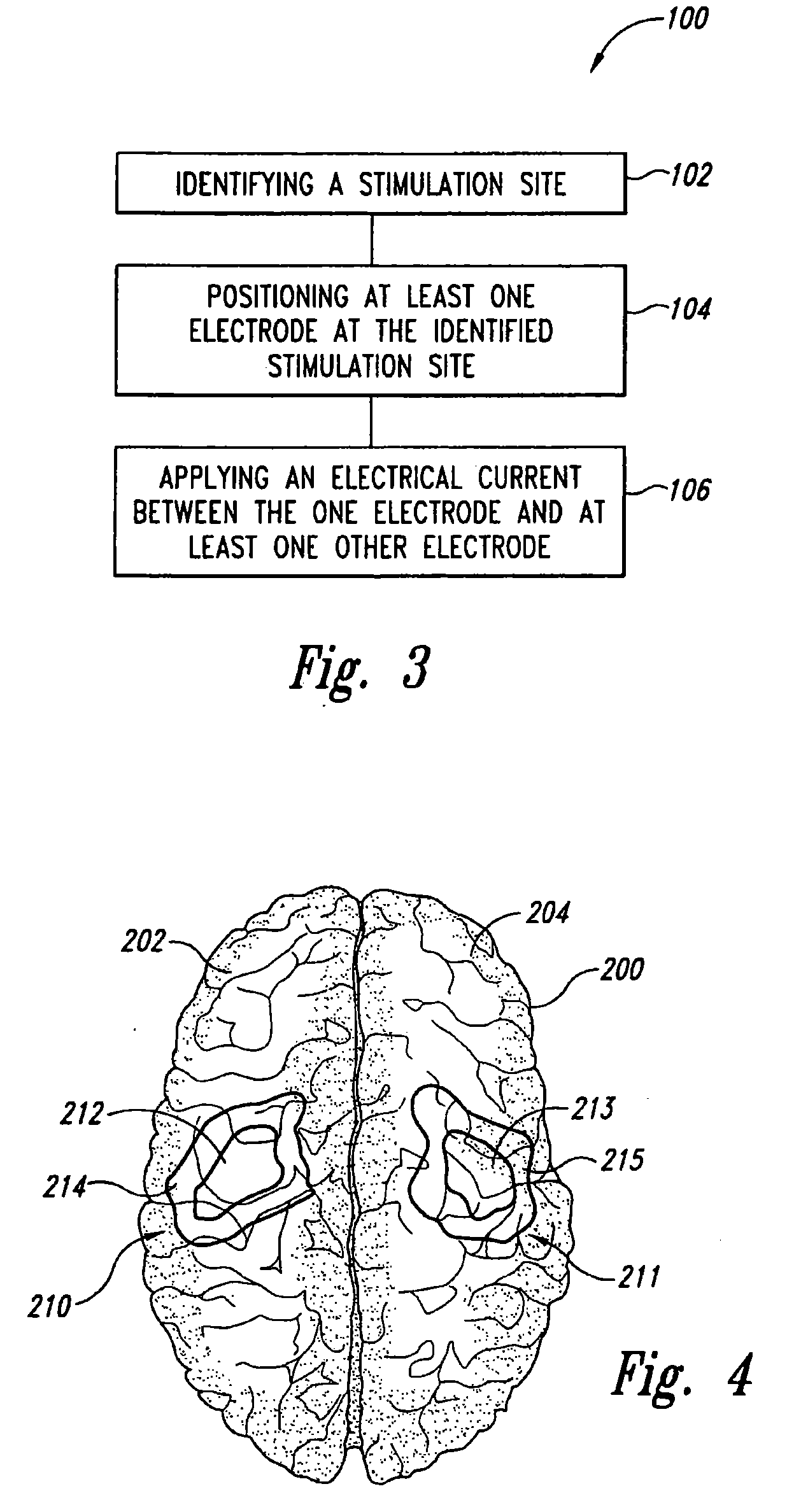 Methods and apparatus for effectuating a lasting change in a neural-function of a patient