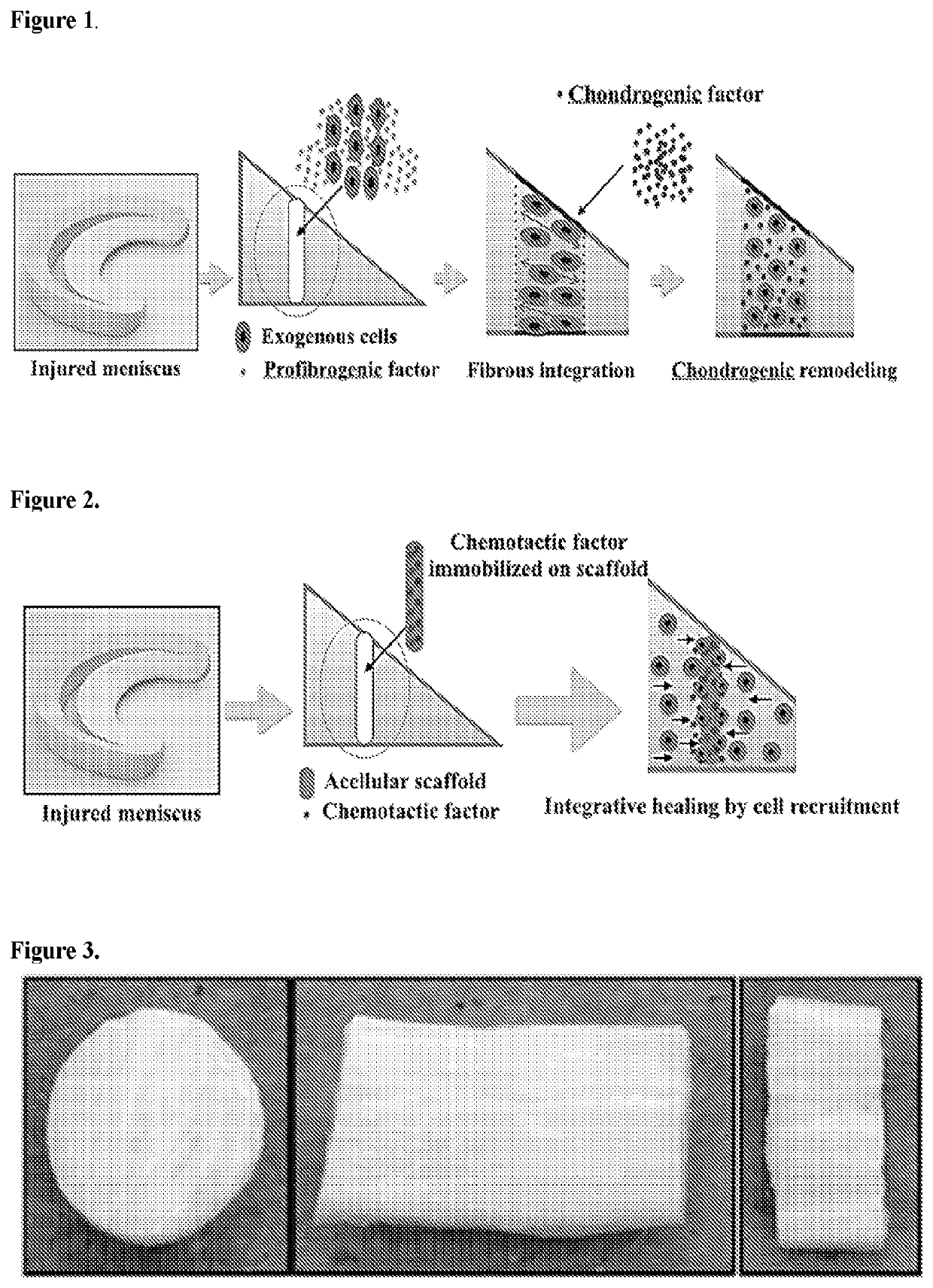 Functionalized Scaffold To Promote Meniscus Repair