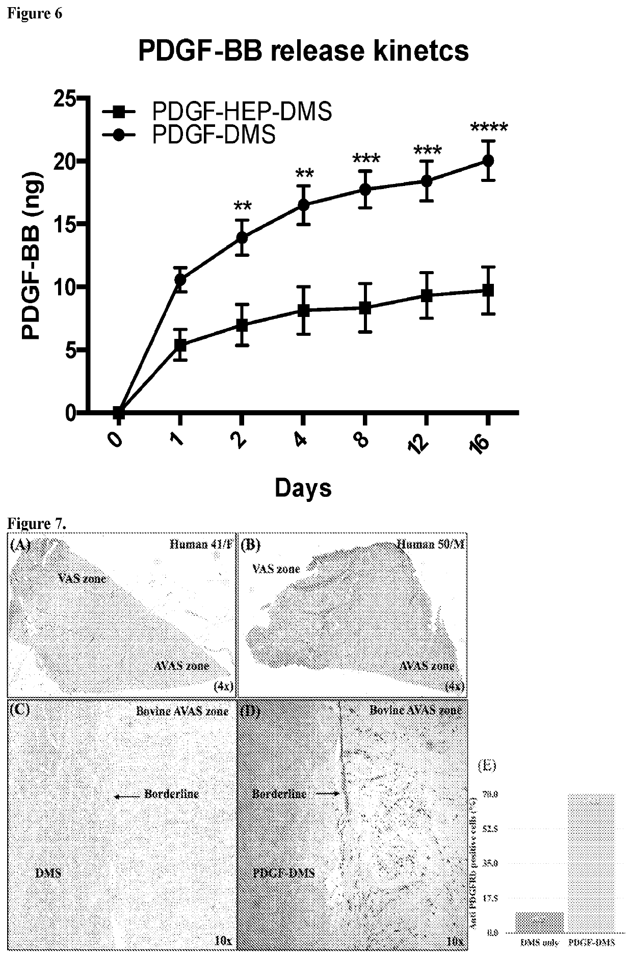 Functionalized Scaffold To Promote Meniscus Repair