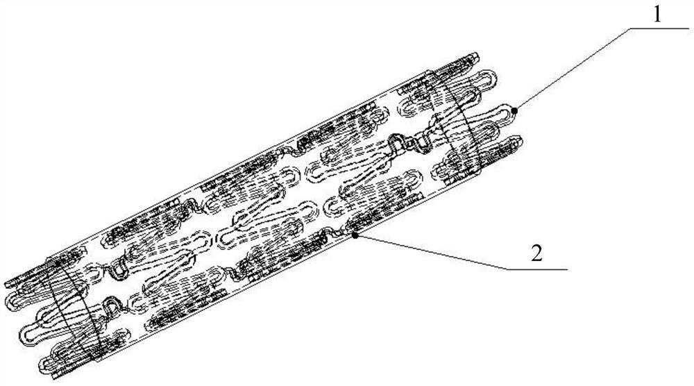 Covered stent and preparation method thereof