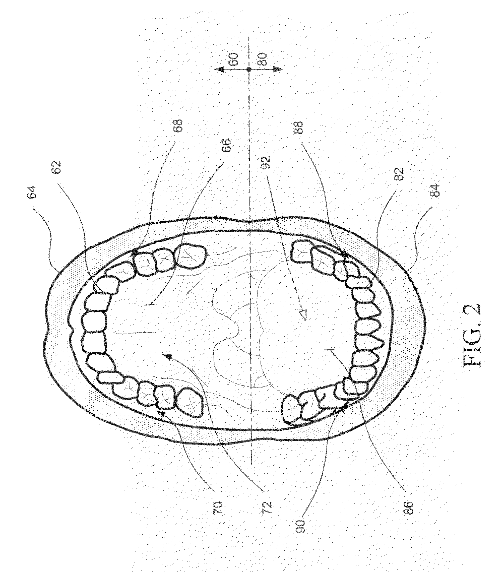 Intraoral behavior monitoring and aversion devices and methods