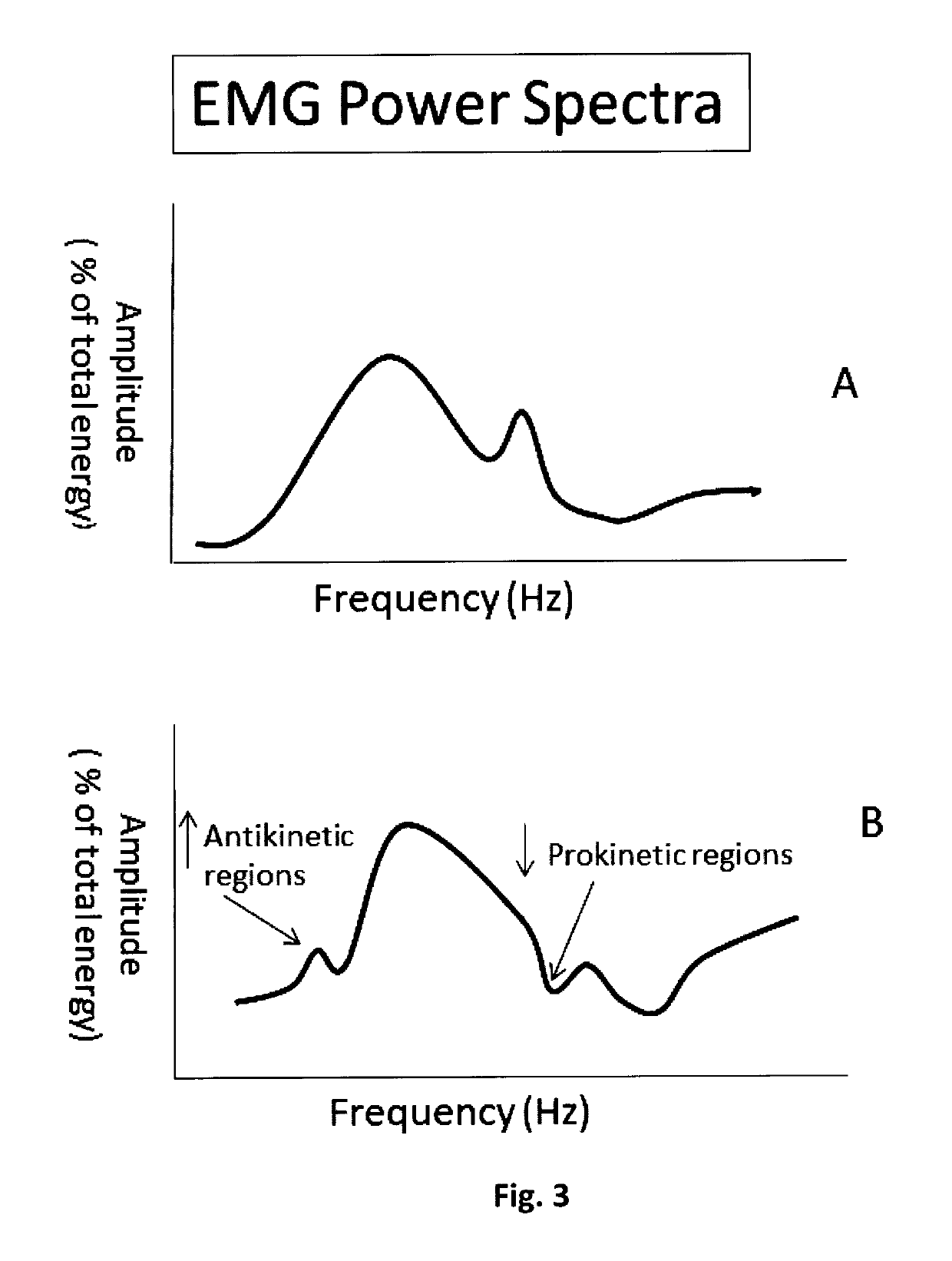 Diagnostic method and apparatus for brain injury based on EMG frequency power spectra analysis