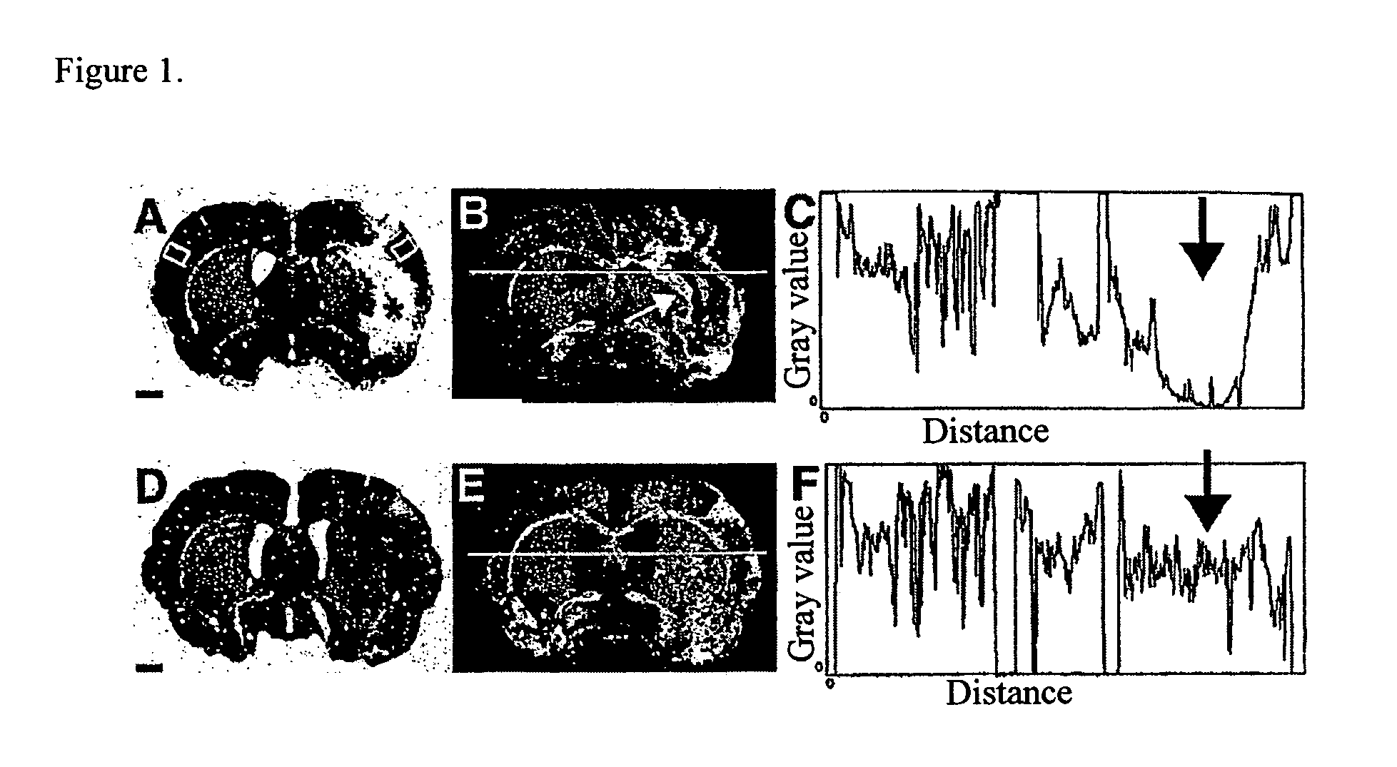 Diagnostic substance and method for the analysis of metabolism processes in the brain