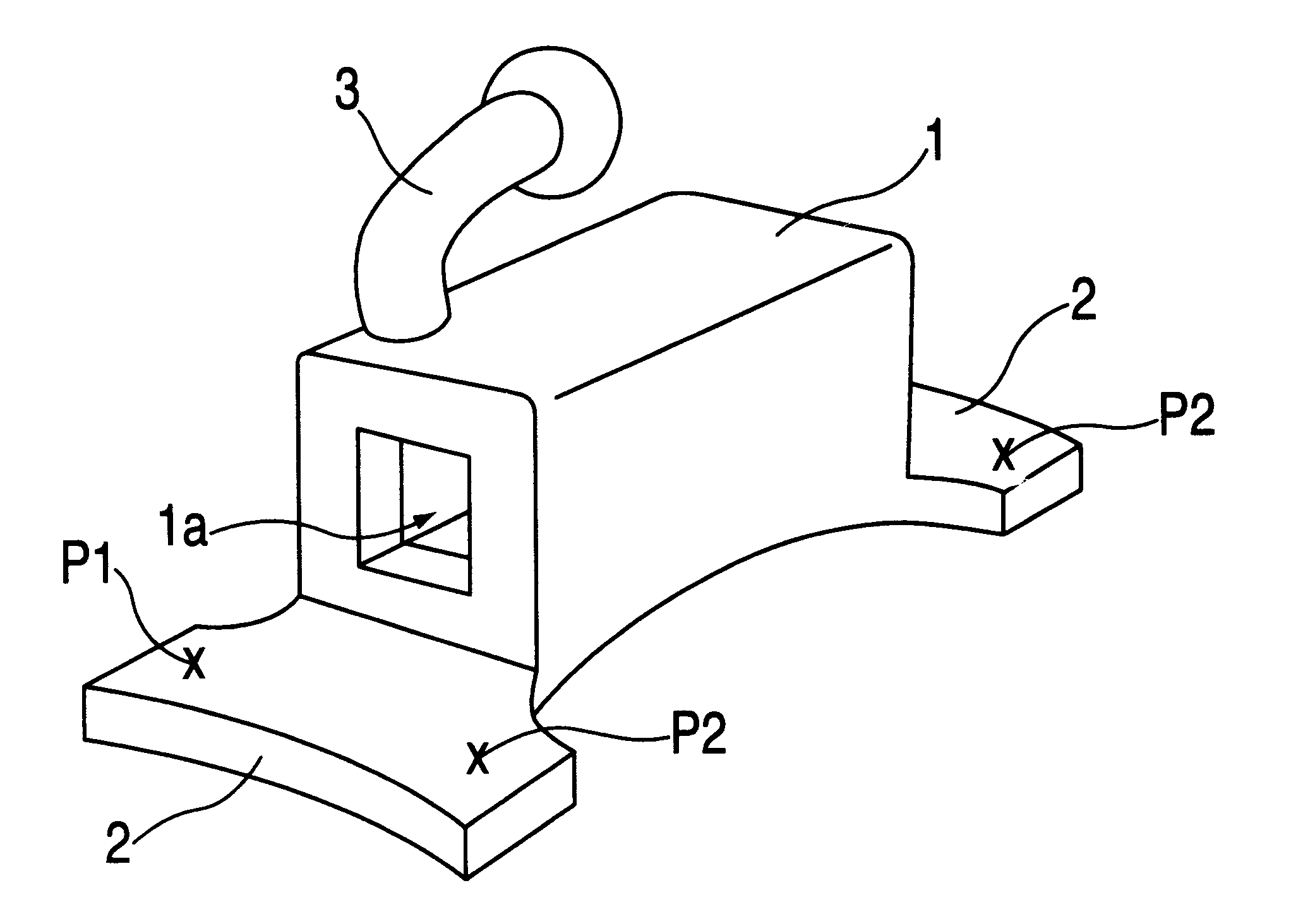 Orthodontic device