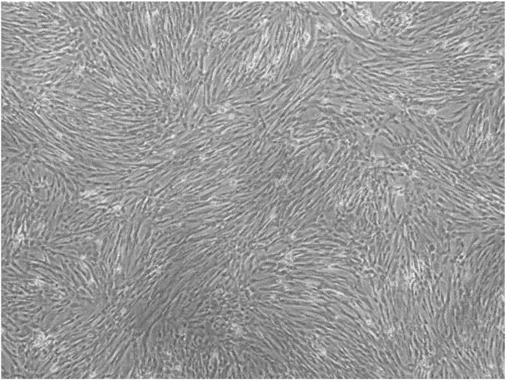 Human placenta chorionic mesenchymal stem cell separation method
