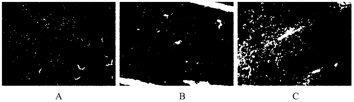 Alcoholic extract of Schisandra chinensis and its application in the preparation of anti-hepatic fibrosis drugs