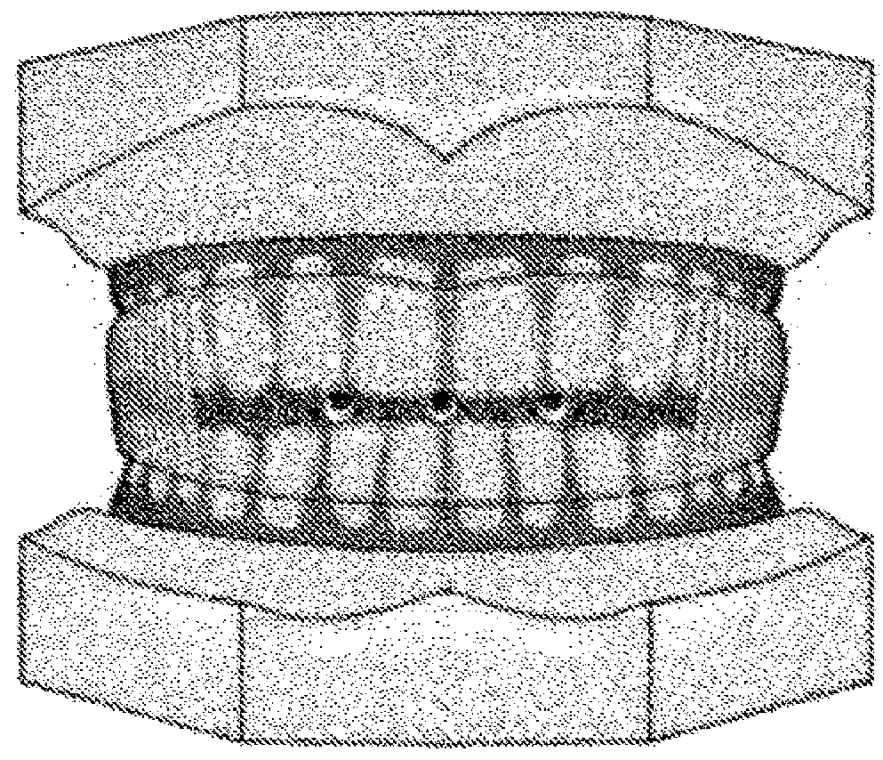 Dental treatment method combining tooth positioners and arch aligners