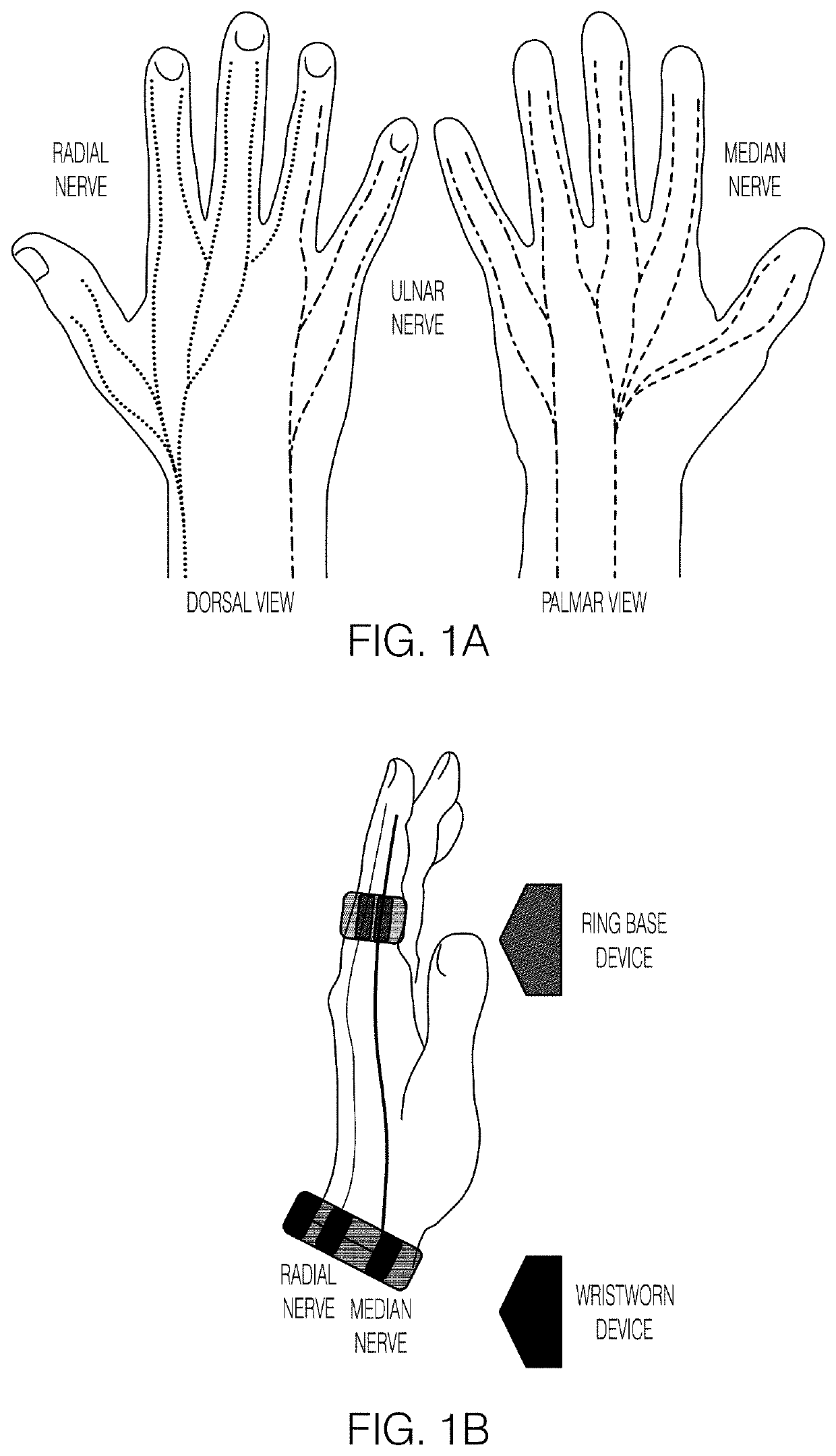 Systems and methods for peripheral nerve stimulation in the finger or hand to treat hand tremors