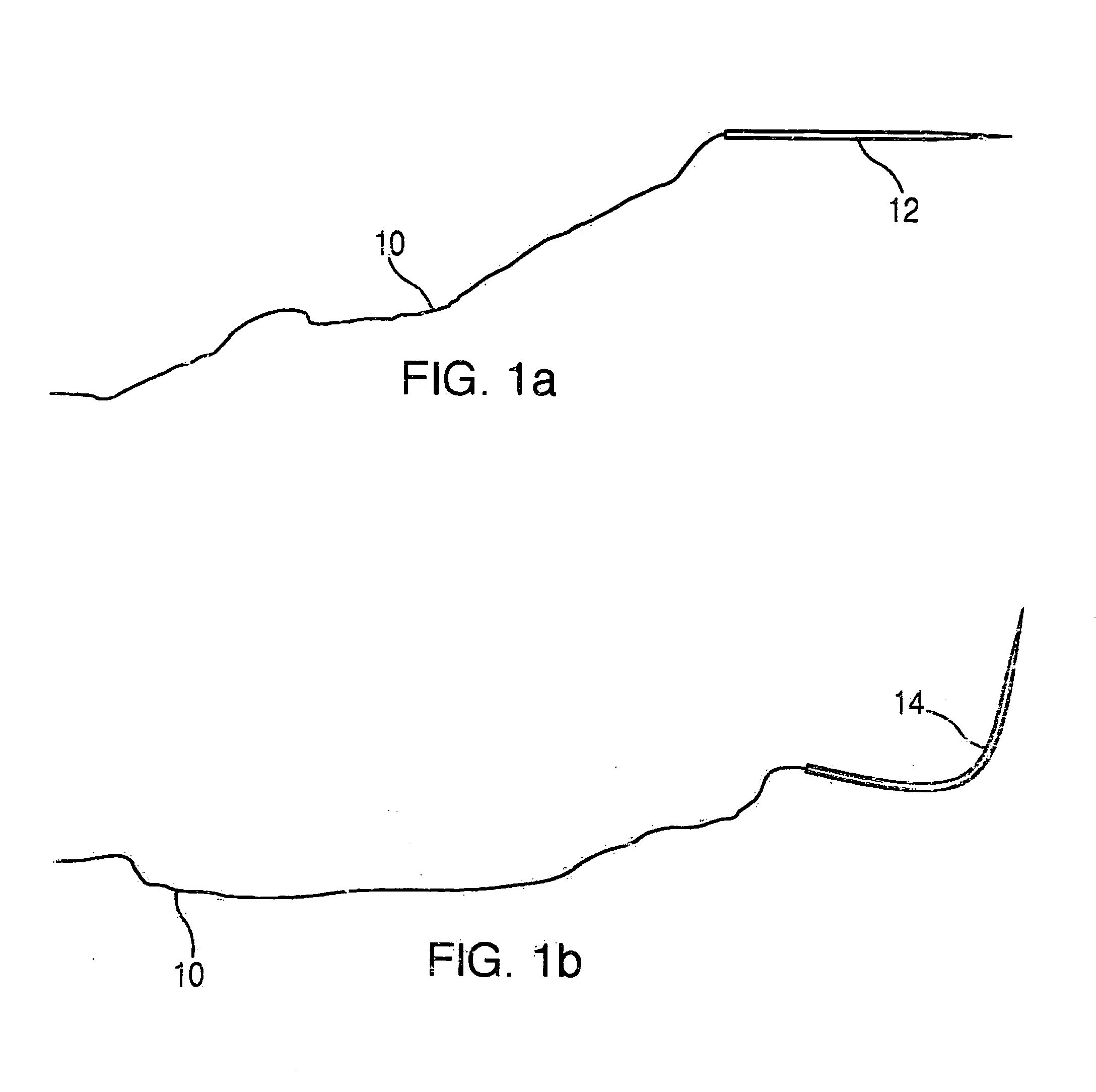 Suture passer and method of passing suture material