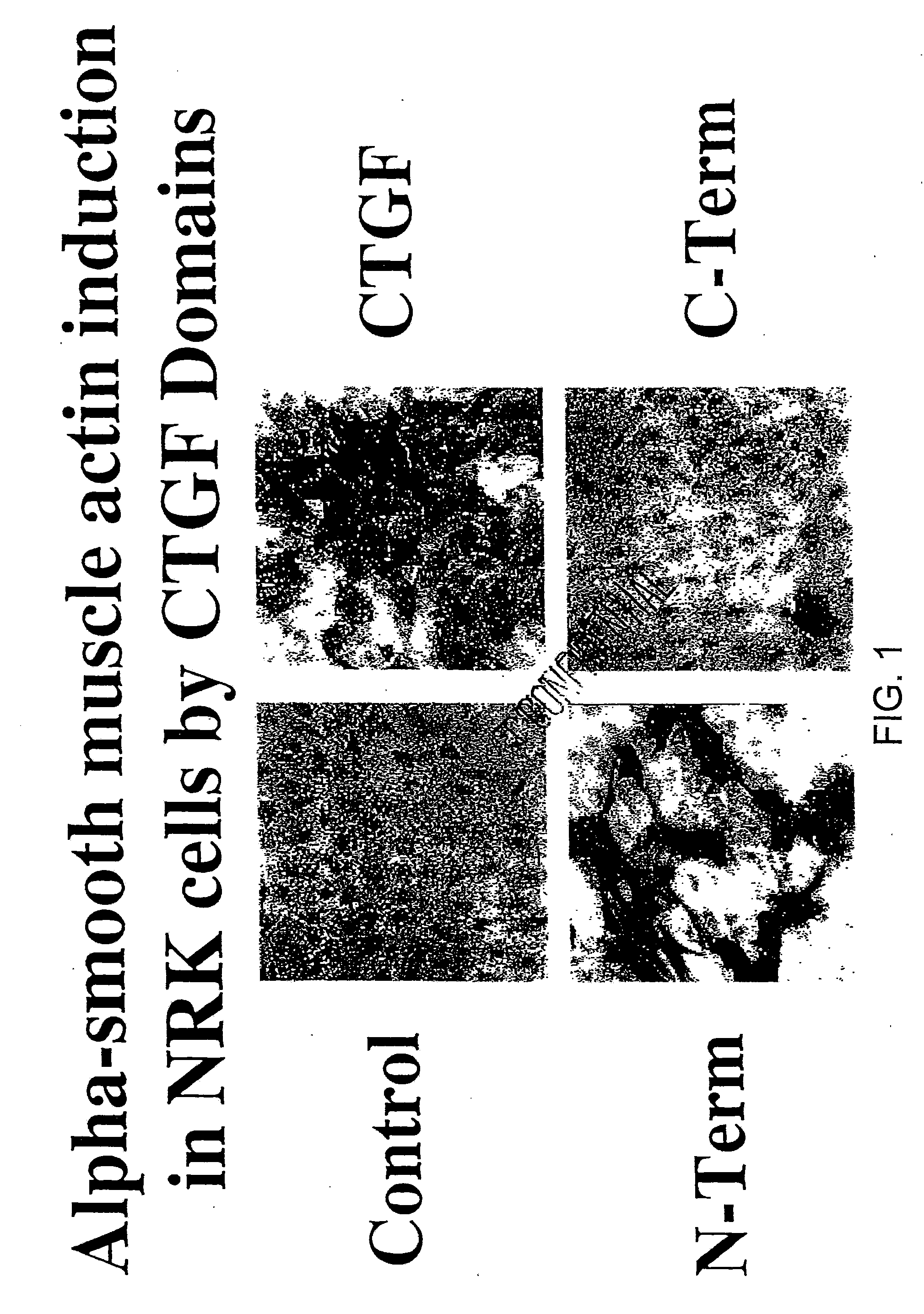 Connective Tissue Growth Factor Fragments and Methods and Uses Thereof