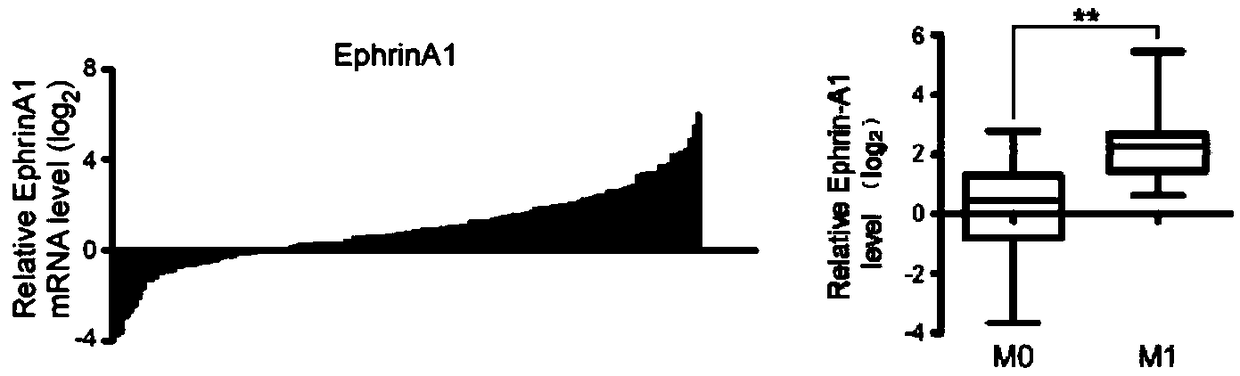 Application of EphrinA1 protein in preparation of drug for inhibiting tumor cell invasion and metastasis