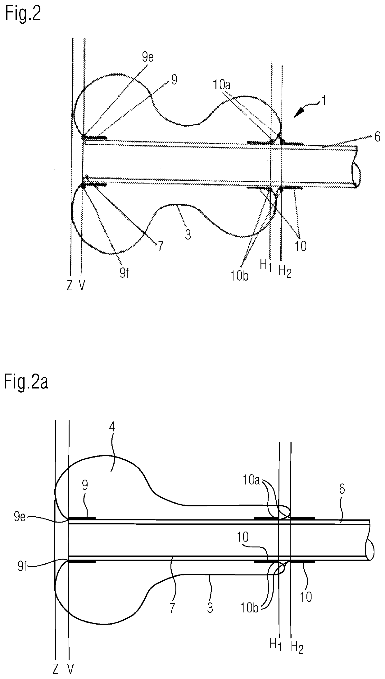 Method and device for the trans-anal drainage of stool from the rectum of a patient and/or for the trans-anal application of inflowing liquid through a catheter-like element