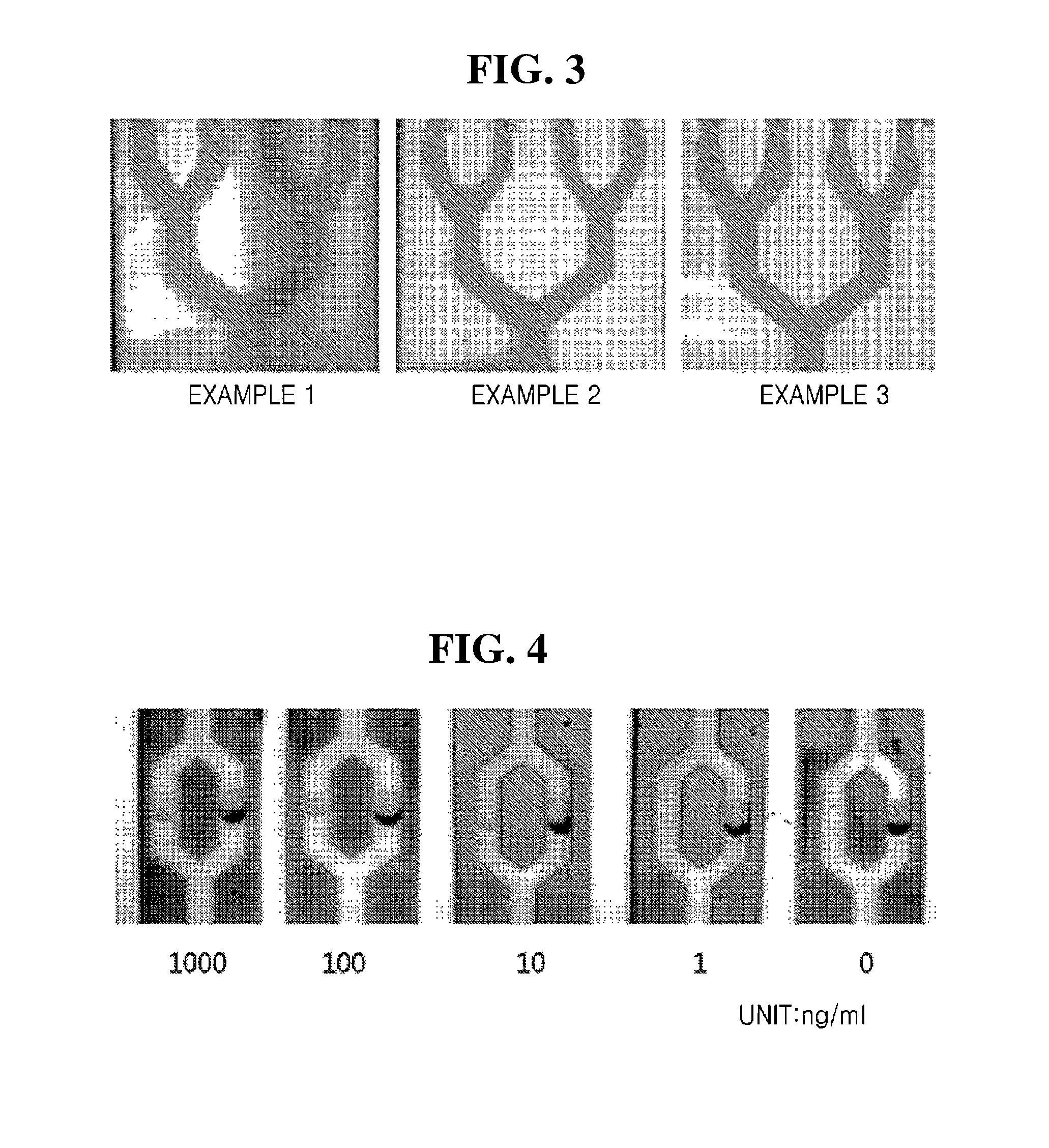 Method for manufacturing multiple-diagnosis membrane sensor by using screen printing
