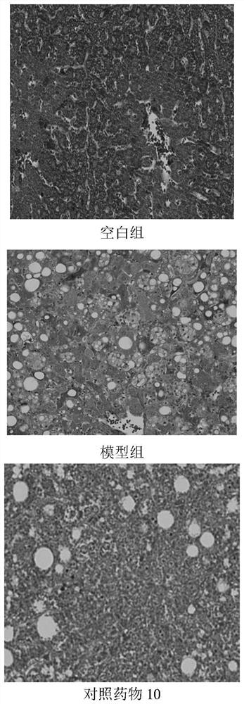 Application of Xianglian product or combination of Xianglian product and antibiotics in anti-helicobacter pylori drugs