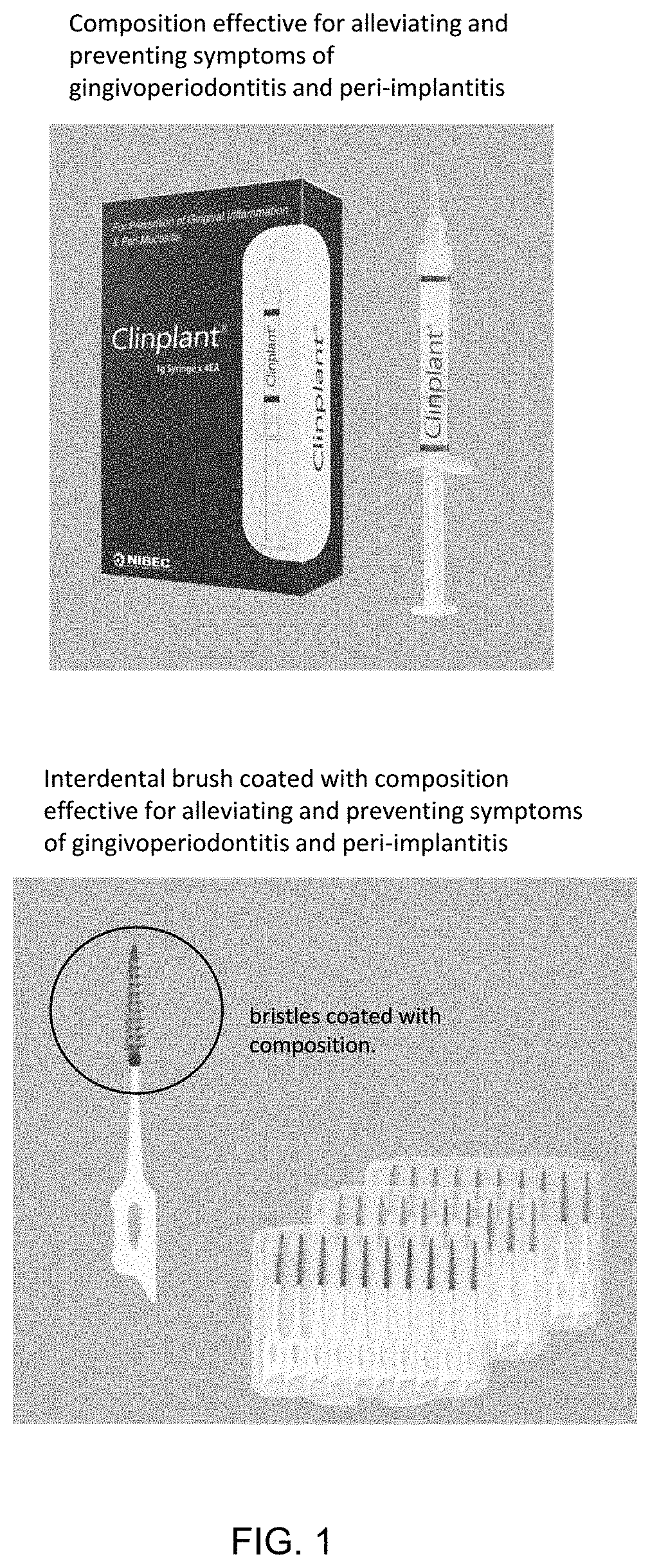 Composition for treating and preventing gingivoperiodontitis or peri-implantitis, and interdental brush coated with same