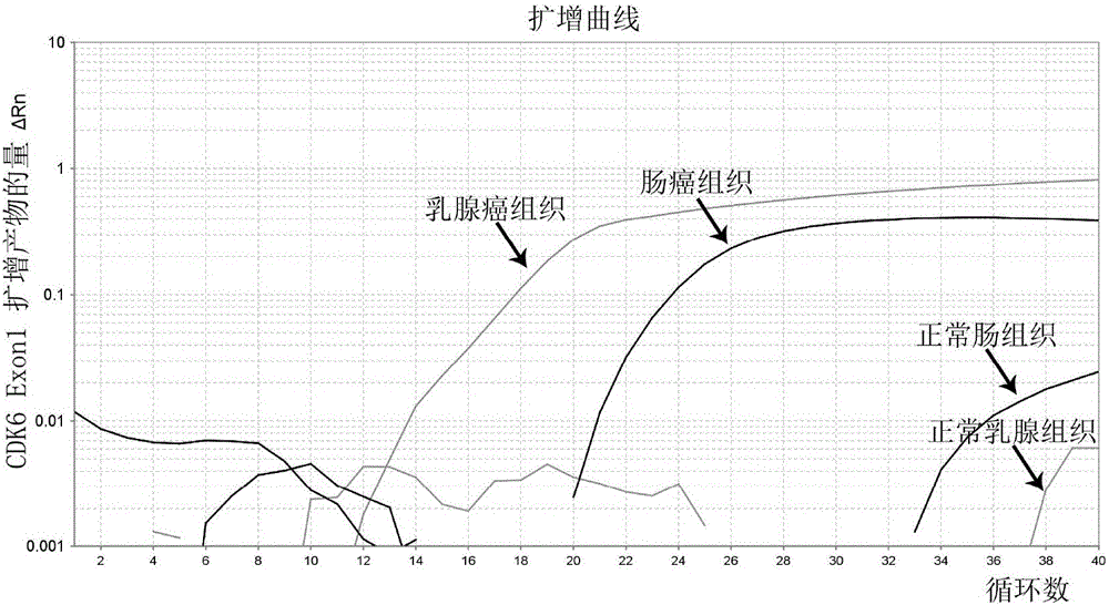 Cycli-dependent kinase 6 (CDK6) gene exon genetic groups used for cancer diagnosis and diagnosis kit