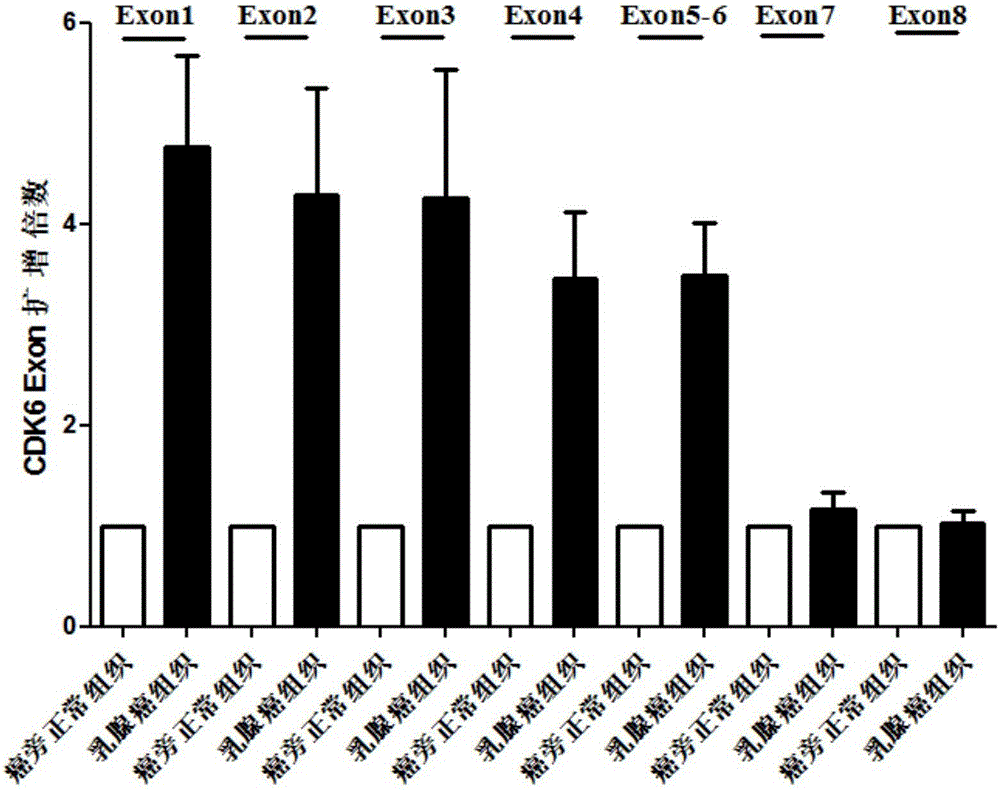 Cycli-dependent kinase 6 (CDK6) gene exon genetic groups used for cancer diagnosis and diagnosis kit