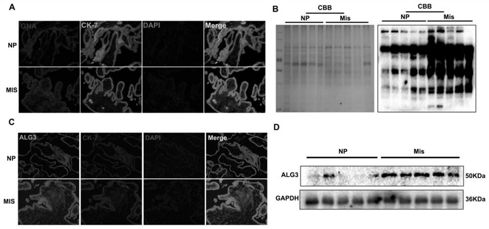 Biomarker for diagnosing abortion and application thereof