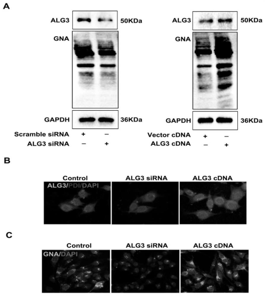 Biomarker for diagnosing abortion and application thereof