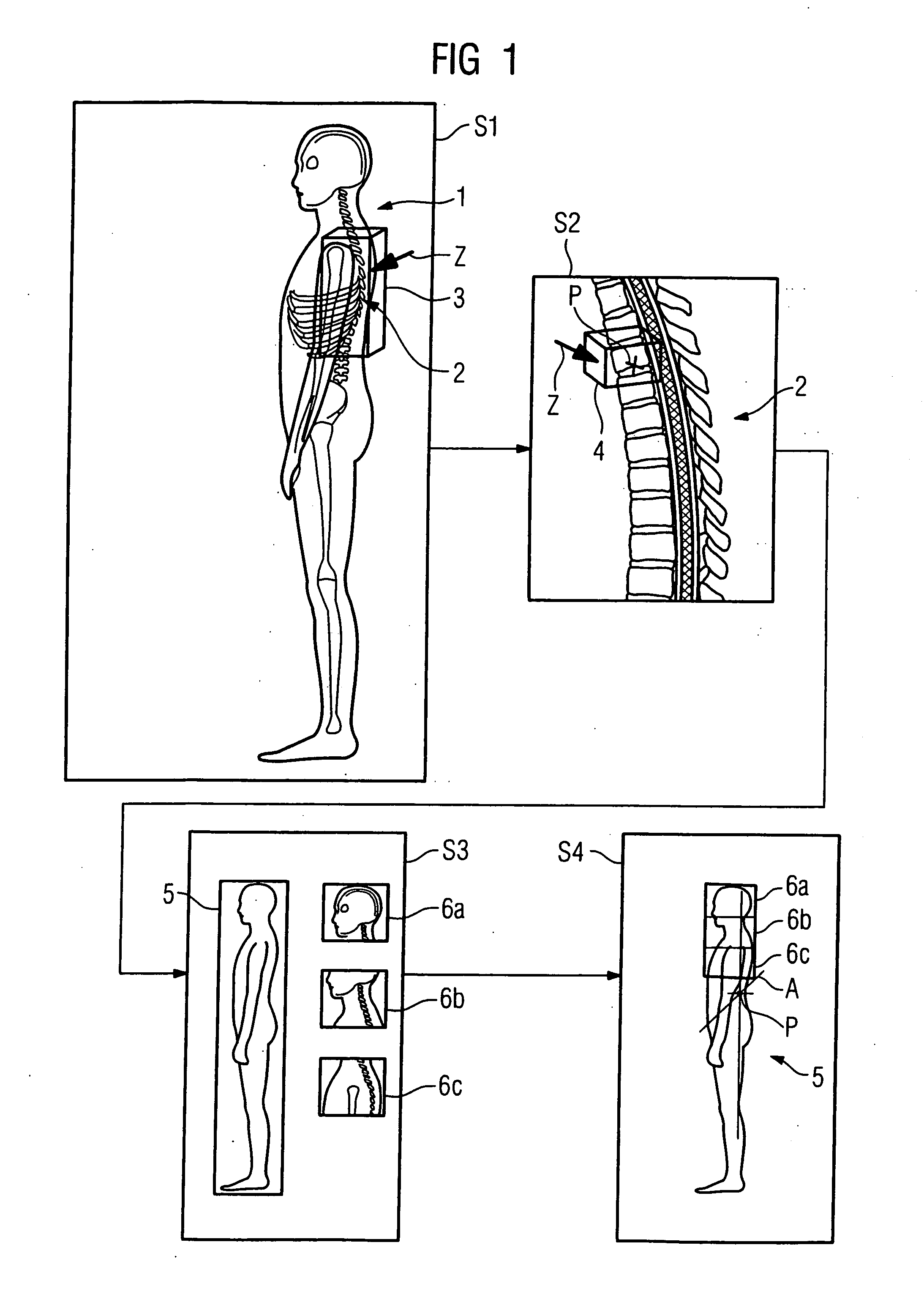 Method and apparatus for acquisition and evaluation of image data of an examination subject